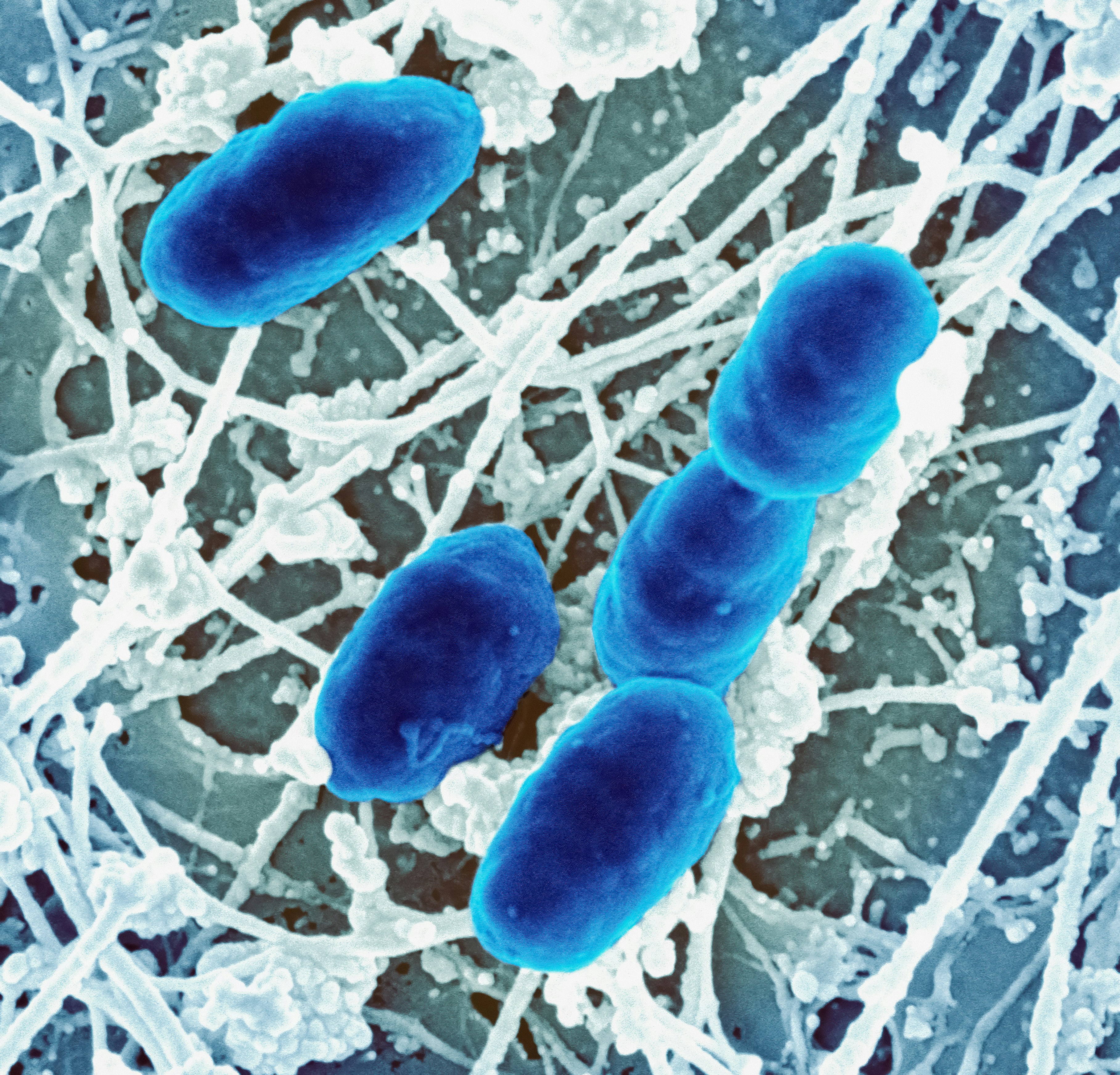 How To Tell If Your Microbiome Struggles With Oxalates