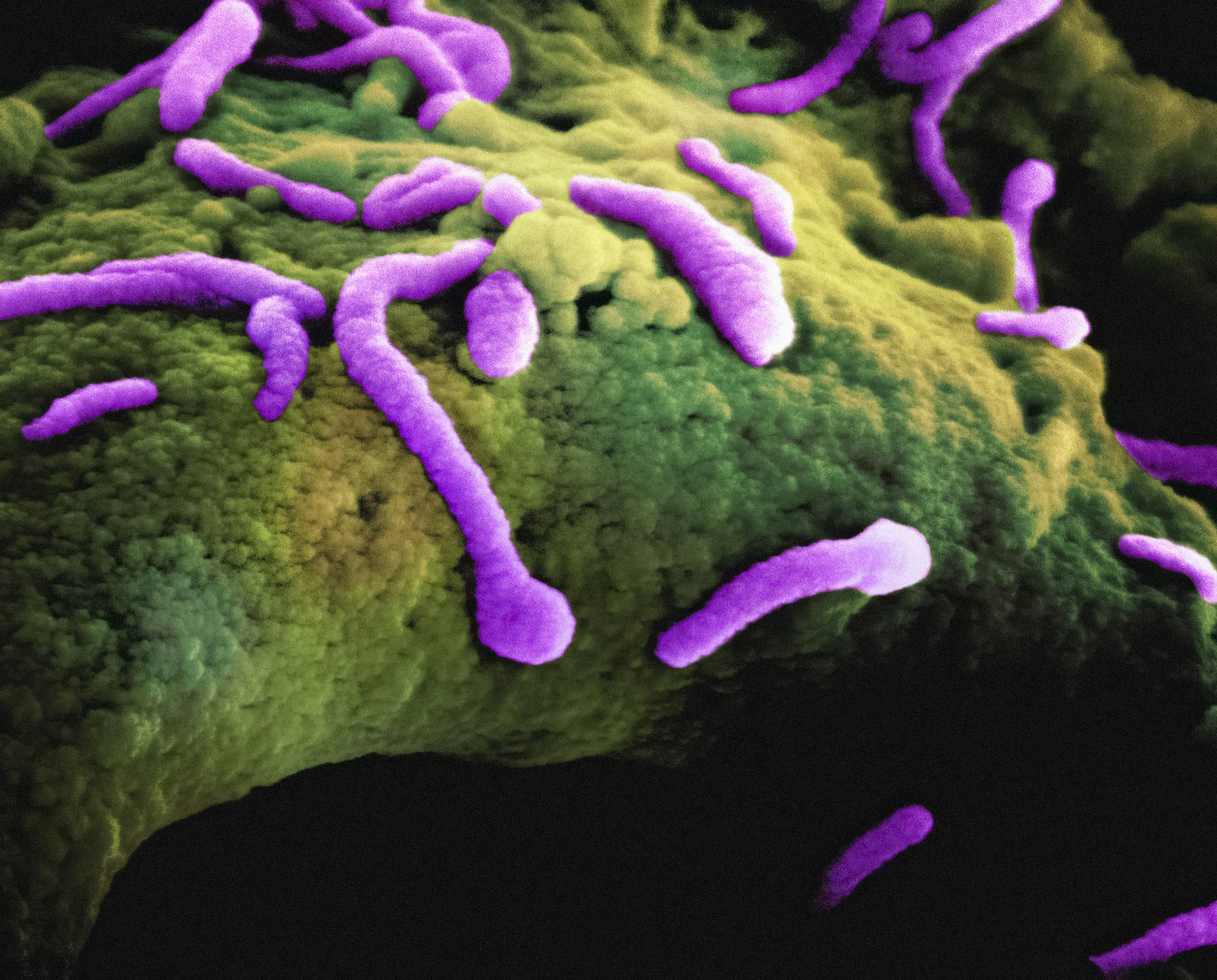 Do Oxalates Harm Beneficial Gut Bacteria? 7 Essential Answers