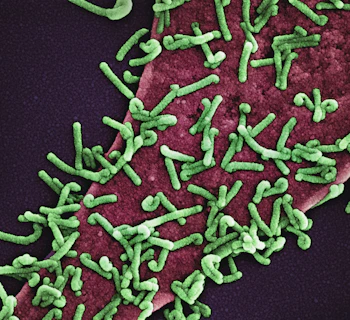 a close up of a cell with green algae