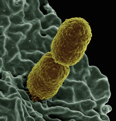 a close up of a cell phone with a yellow substance