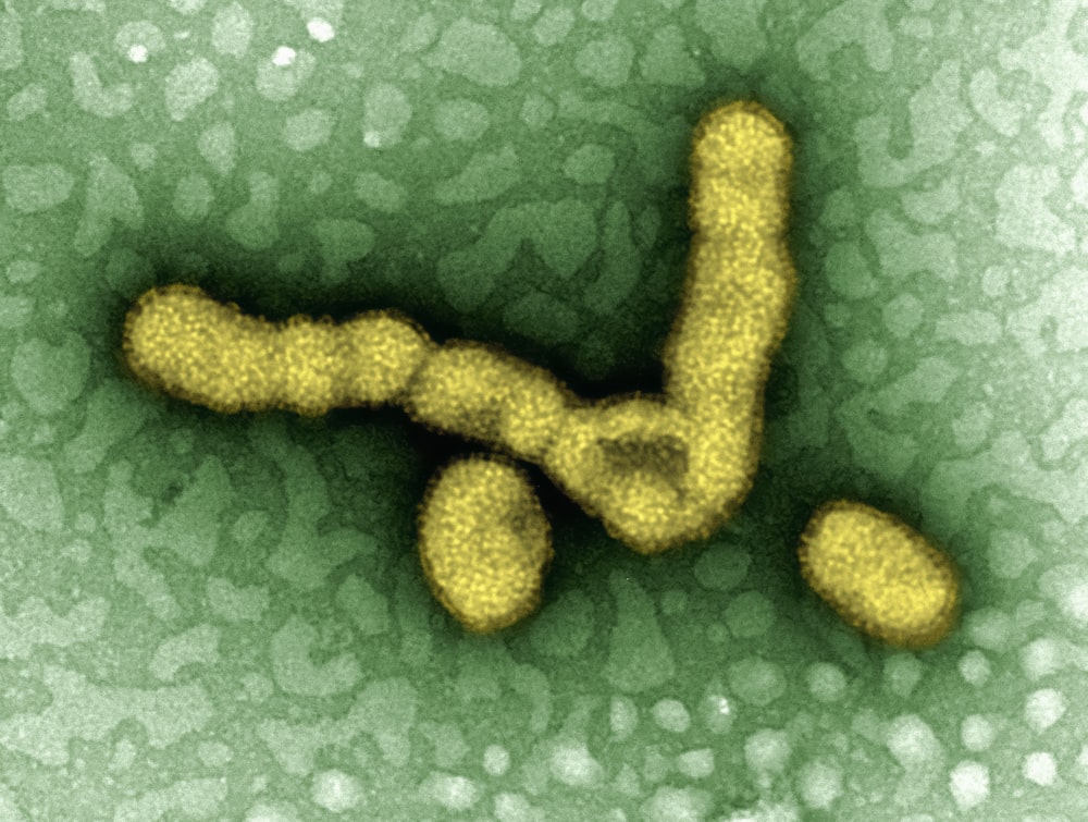 a cell with a yellow substance inside of it