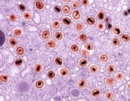 an image of a cell with blood cells in it