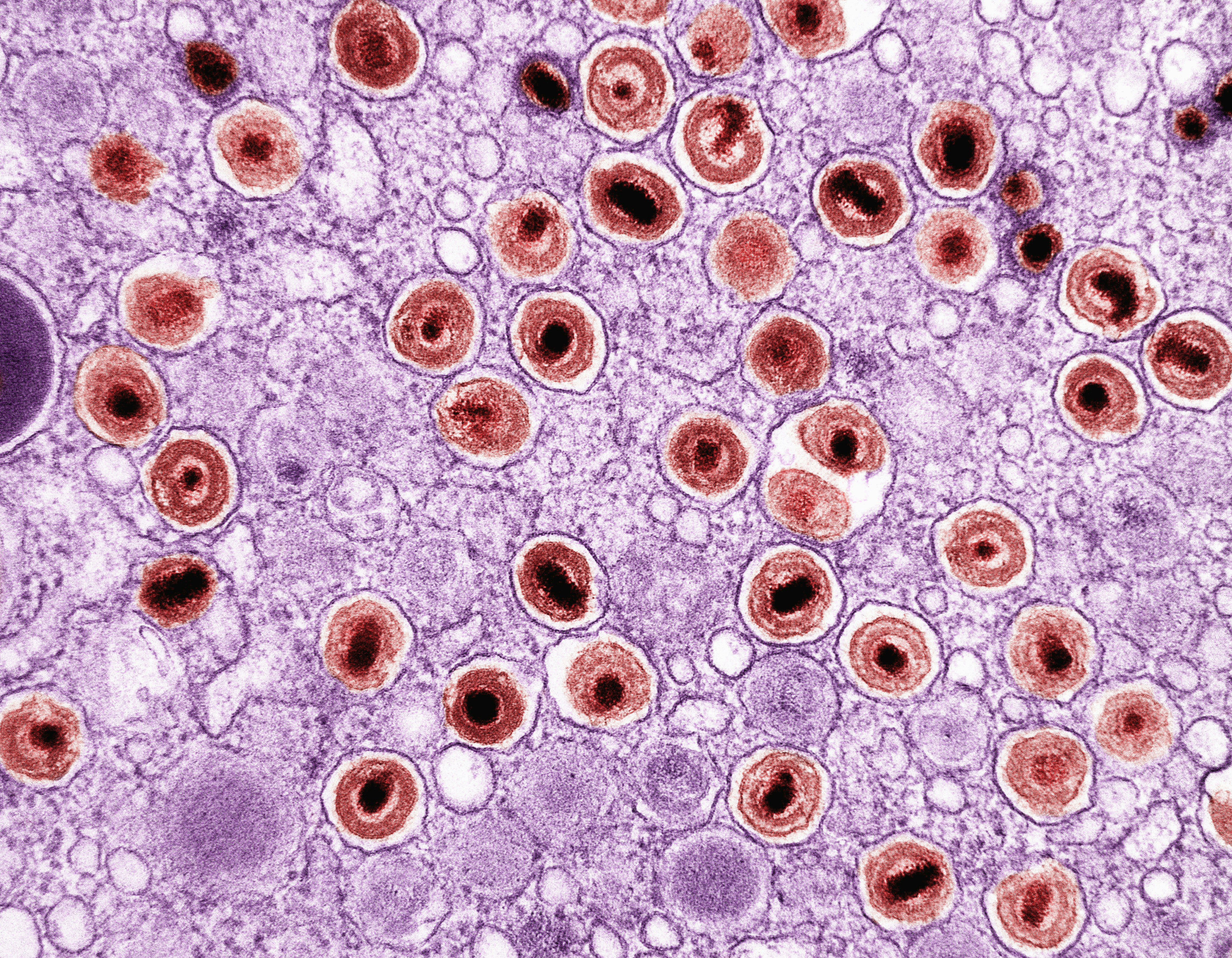 Cytomegalovirus (CMV) Particles Transmission electron micrograph of cytomegalovirus (CMV) particles (red) found within intracellular vesicles of an infected macrophage (purple). Image captured at the NIAID Integrated Research Facility (IRF) in Fort Detrick, Maryland. Credit: NIAID https://www.flickr.com/photos/niaid/53215346561/