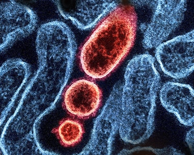 a close up of a blood cell with red blood cells