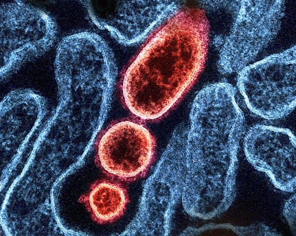 a close up of a blood cell with red blood cells
