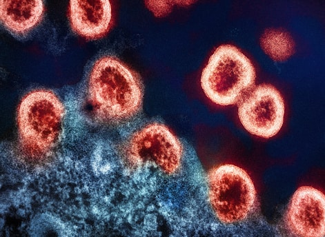 a group of red and black cells on a blue background