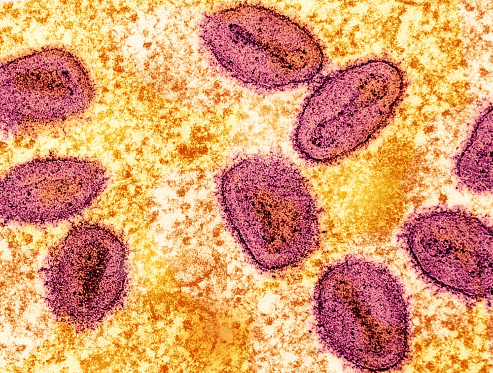 Un primer plano de una célula animal con pequeñas células púrpuras