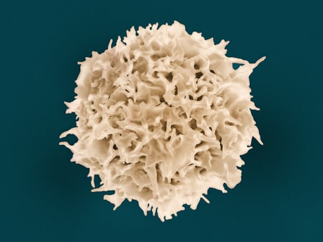 Sistema inmune leucopenia inmunología terapia inmune glóbulos blancos