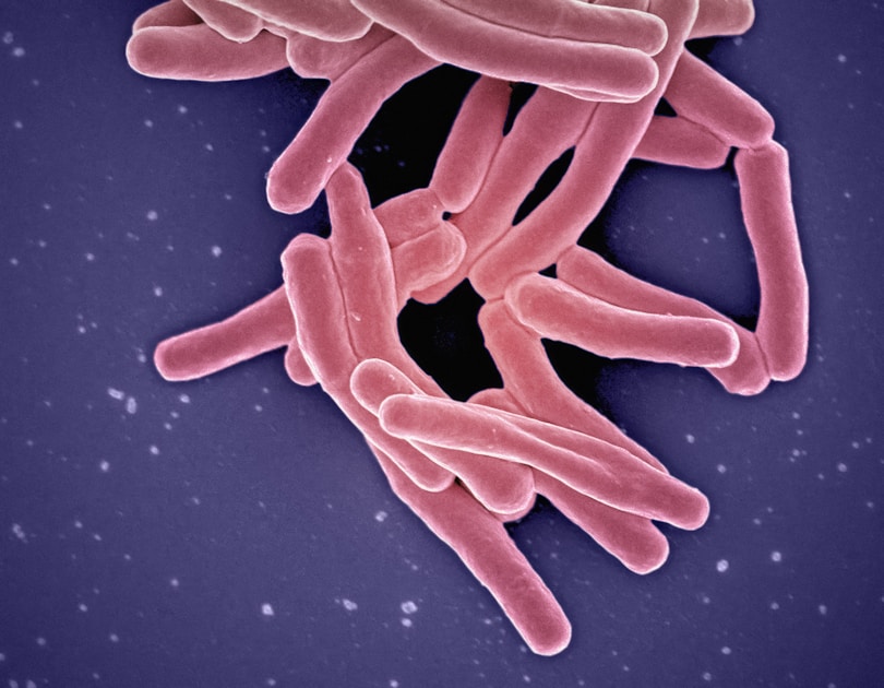 Gut Bacteria and Depression: Harvard Finds the Missing Inflammation Link
