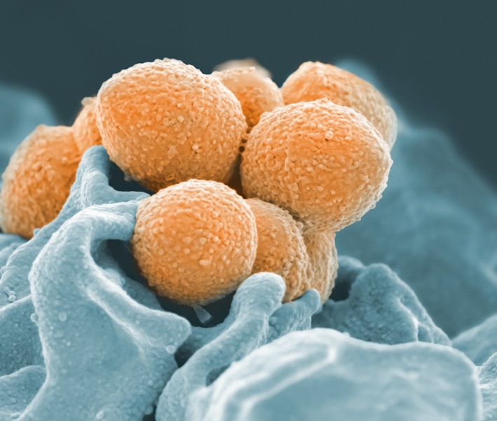 Antraks: Simptomi, uzrok, dijagnoza i efikasno liječenje Bacillus anthracis infekcije