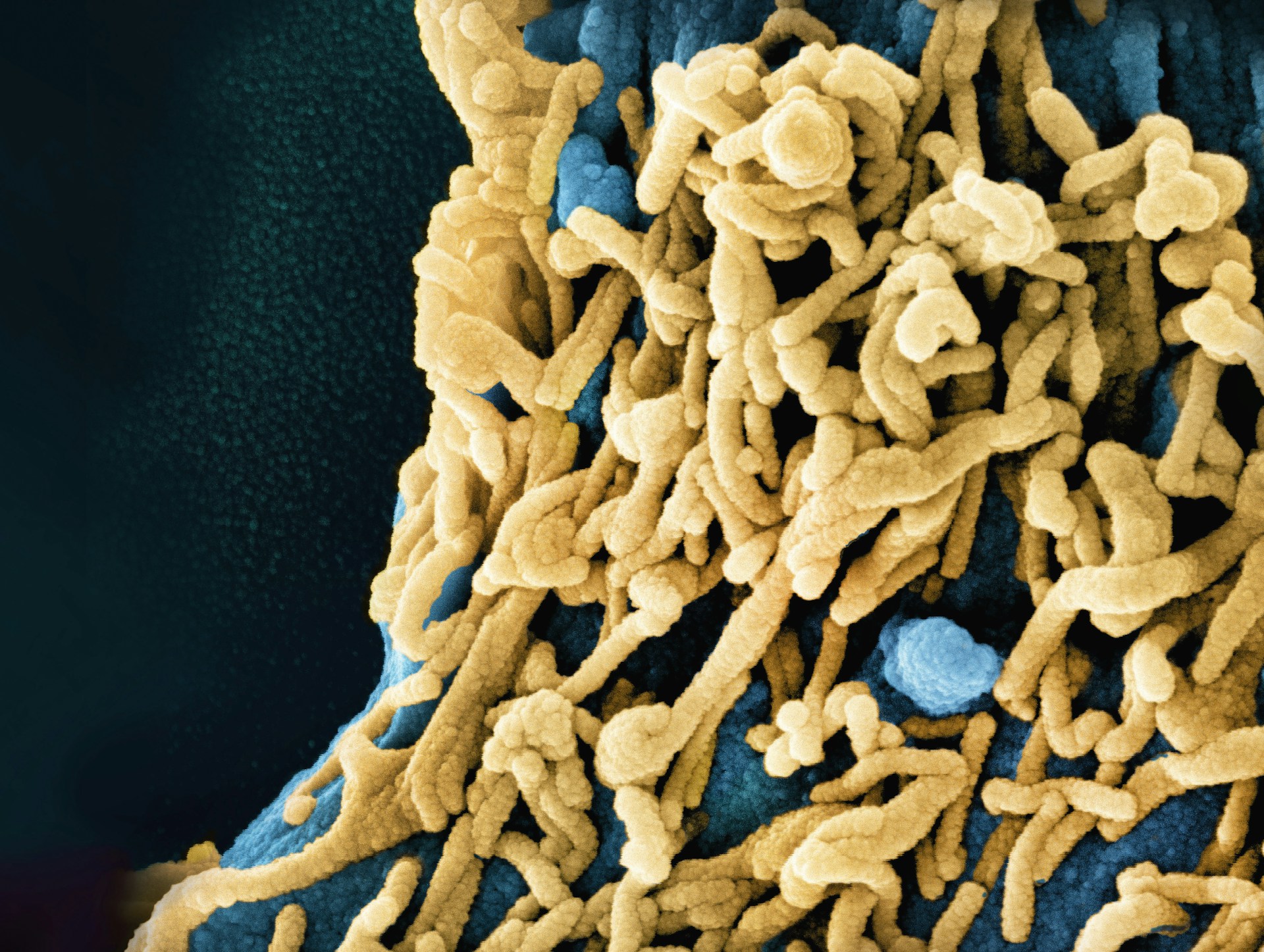 a close up of a blue and yellow substance