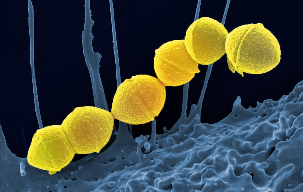 a group of yellow balls sitting on top of a blue substance