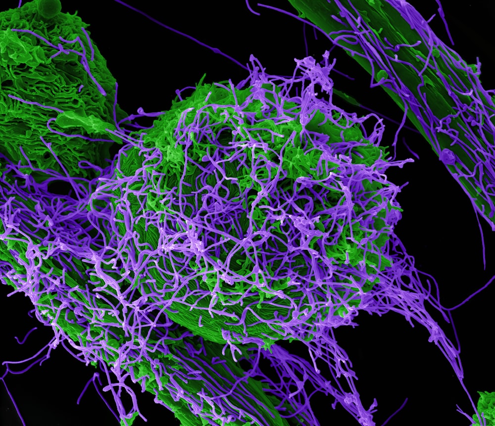 a purple and green cell is shown in this image