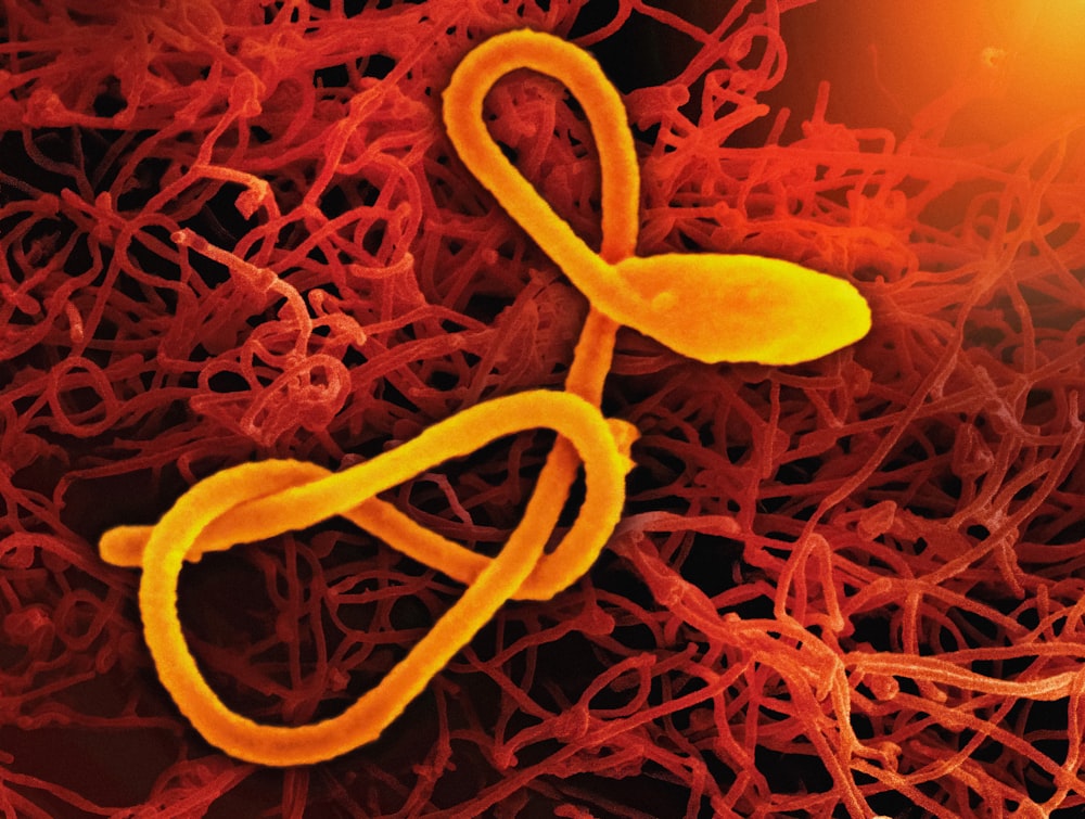 a close up of a cell phone with a yellow cord