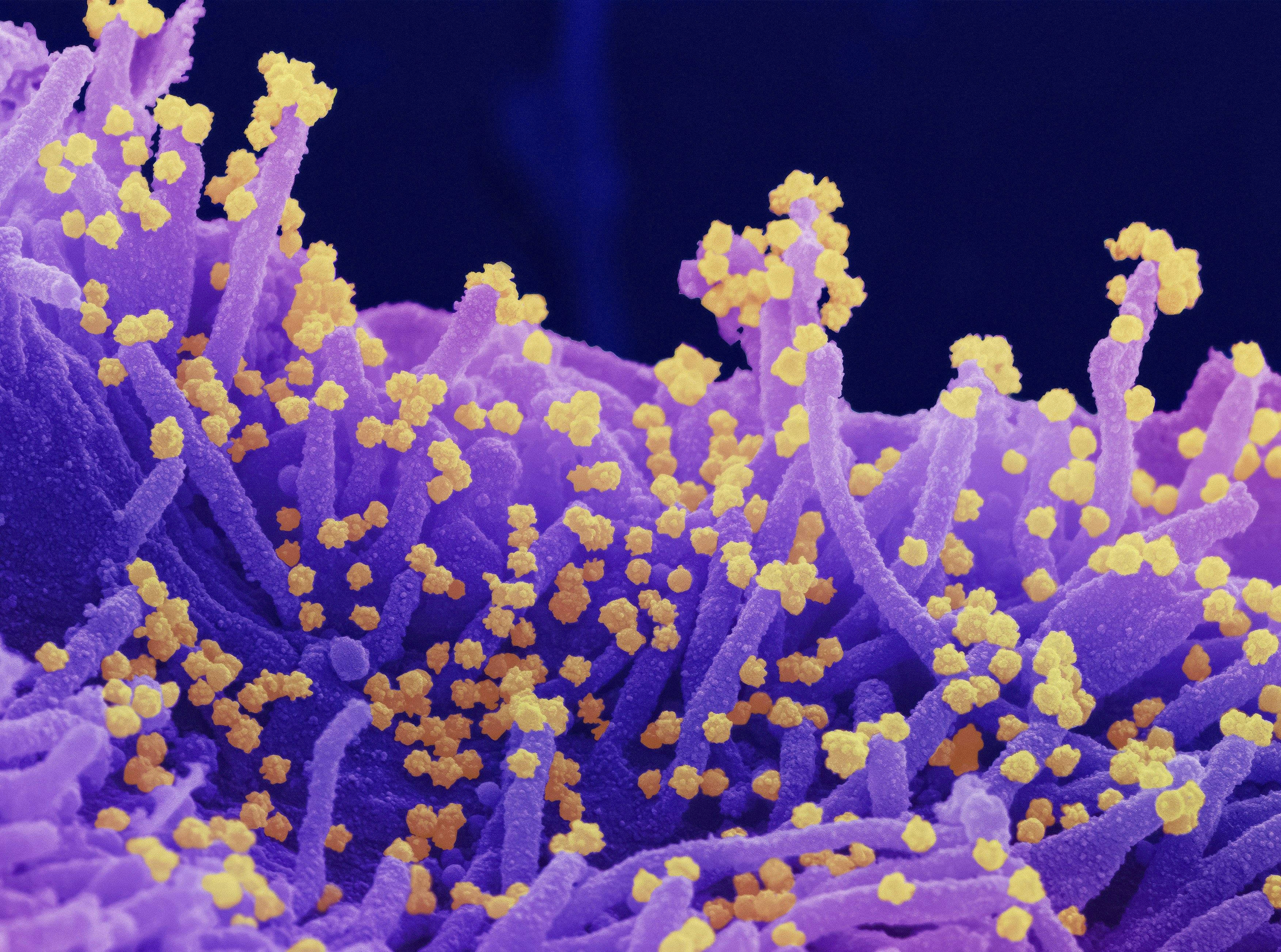 Novel Coronavirus SARS-CoV-2 This scanning electron microscope image shows SARS-CoV-2 (round gold particles) emerging from the surface of a cell cultured in the lab. SARS-CoV-2, also known as 2019-nCoV, is the virus that causes COVID-19. Image captured and colorized at Rocky Mountain Laboratories in Hamilton, Montana. Credit: NIAID https://www.flickr.com/photos/niaid/51269164330/