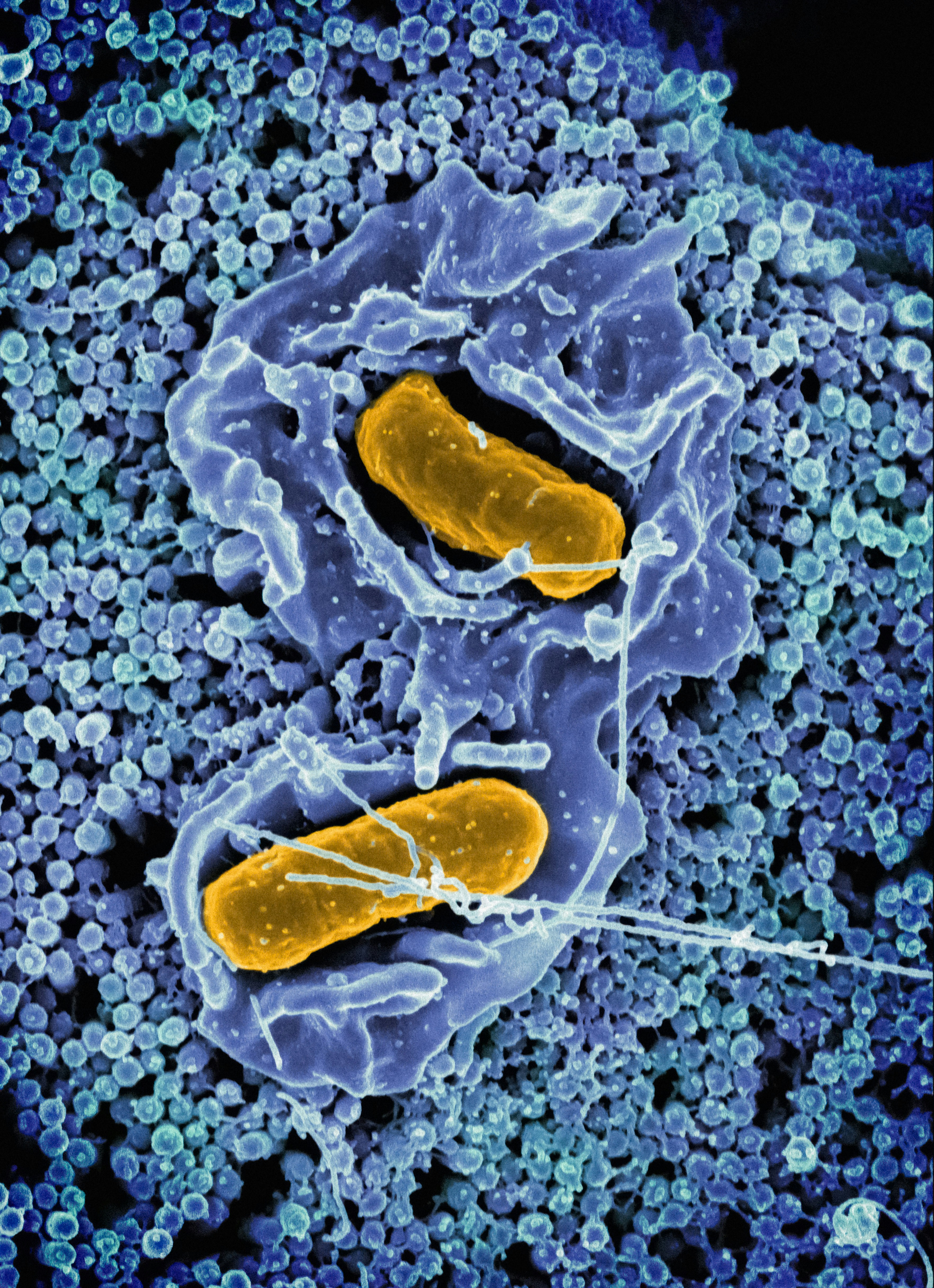 Salmonella Typhimurium invading a human epithelial cell.