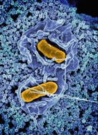 a cell with two yellow cells inside of it
