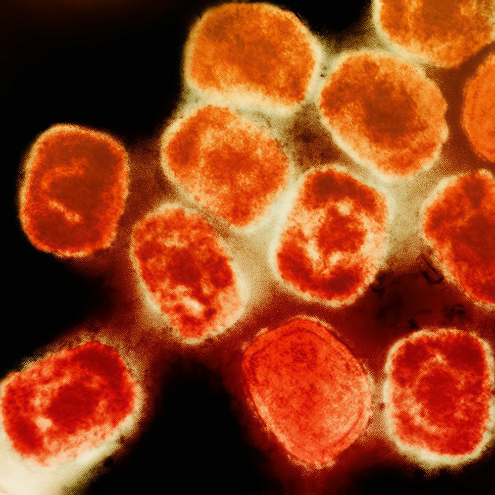 a group of red and yellow cells in a cell