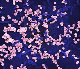 a bunch of pink and blue pills on a blue surface