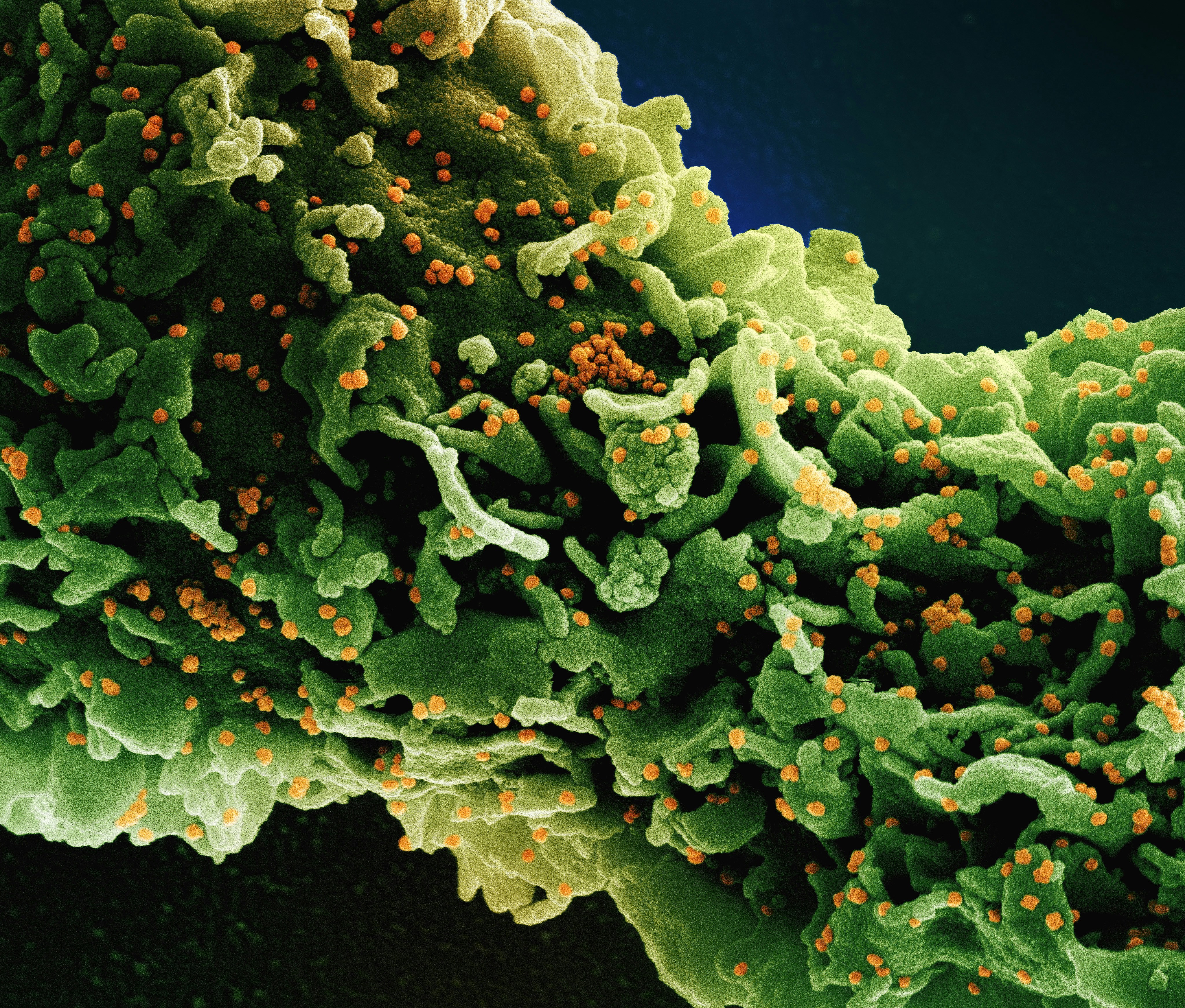 The Role of Digestive Enzymes in Oxalate Processing — 5 Essential
