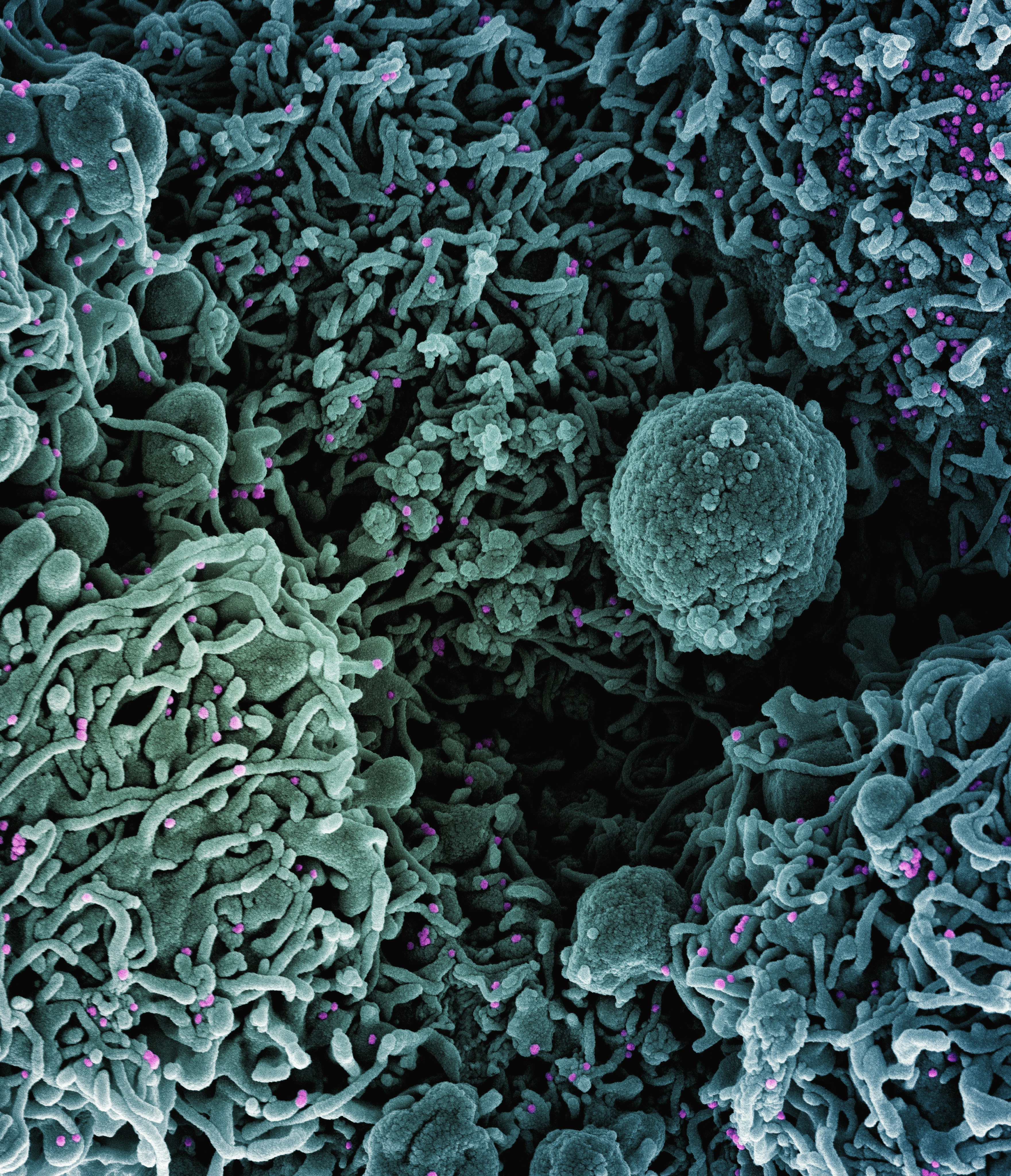 Soil-Based Probiotics and Oxalate Metabolism: 7 Proven Insights