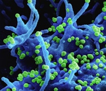 a close up of a blue and green substance