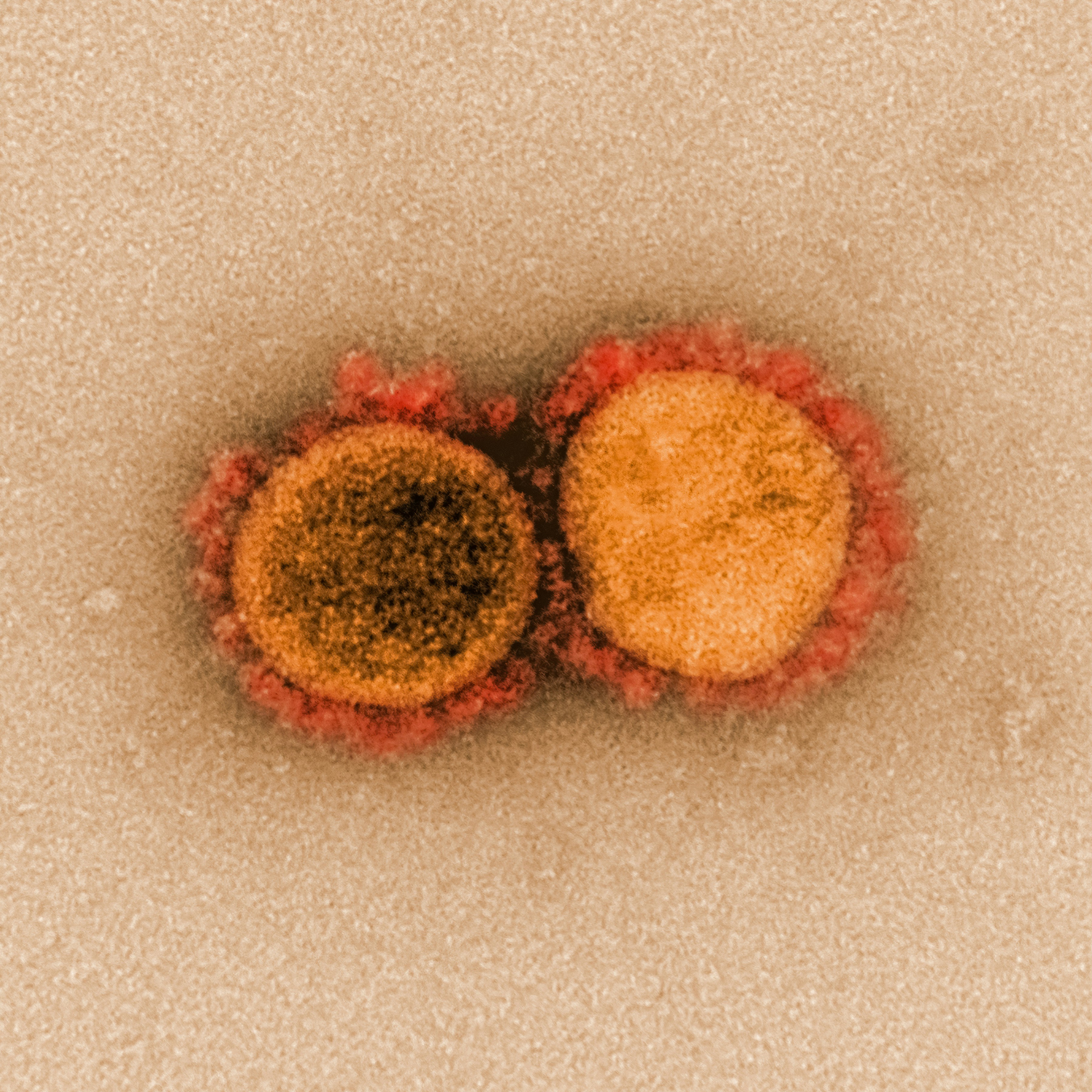 Current placeholder for A diagram of the Herpes Simplex Virus (HSV).