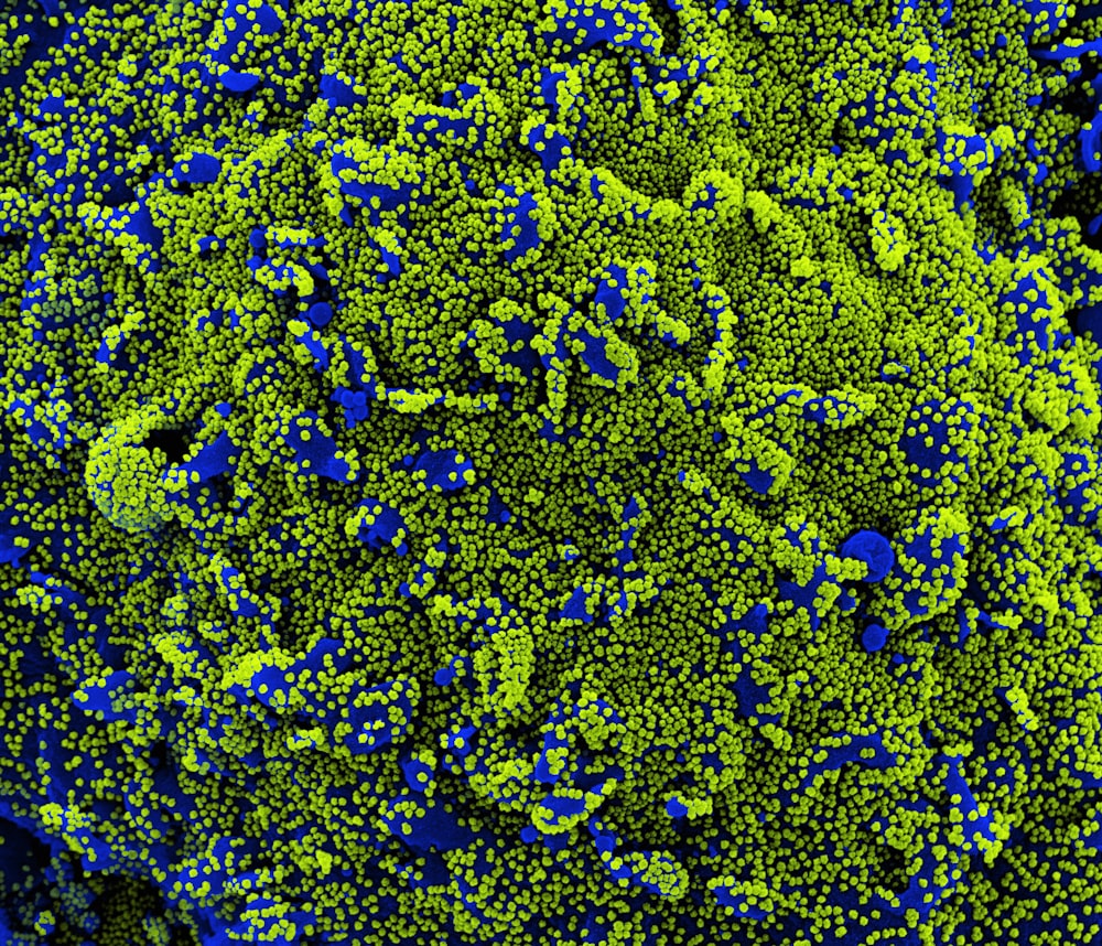 a close up of a green and blue substance