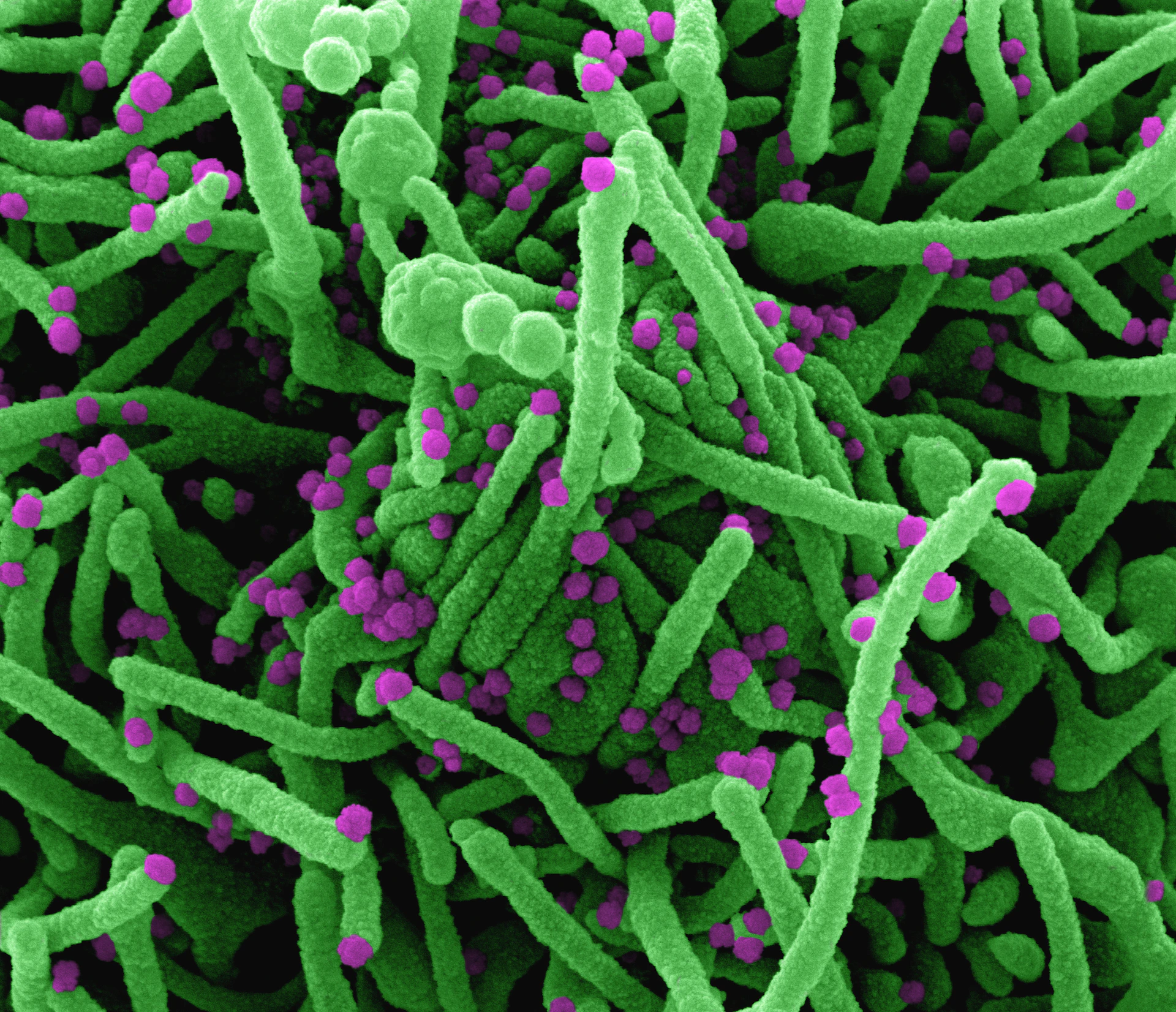 a close up of a green and purple substance