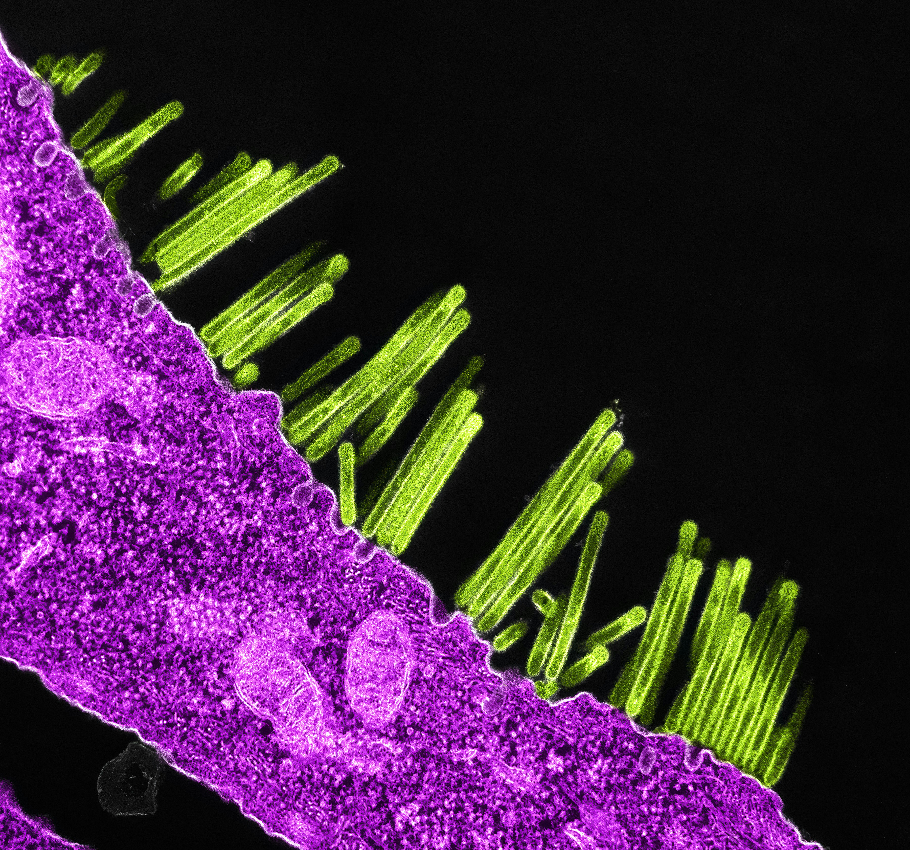 Swine Flu Virus Particles Colorized transmission electron micrograph of SW31 (swine strain) influenza virus particles (green) budding from the surface of a MDCK cell (pink). Image captured and color-enhanced at the NIAID Integrated Research Facility in Fort Detrick, Maryland. Credit: NIAID https://www.flickr.com/photos/niaid/45909788321/