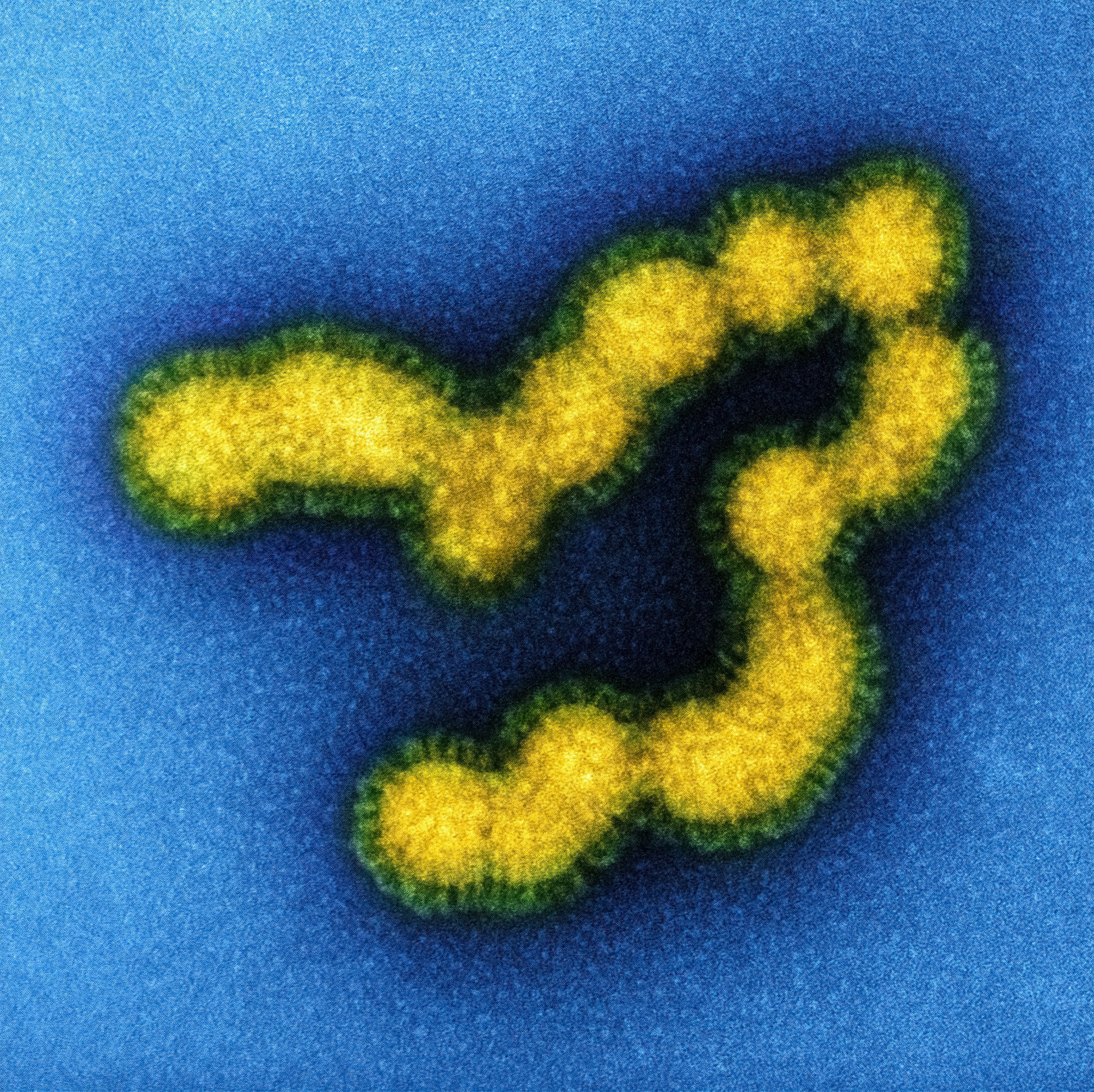 Swine Flu Strain Virus Particles.
