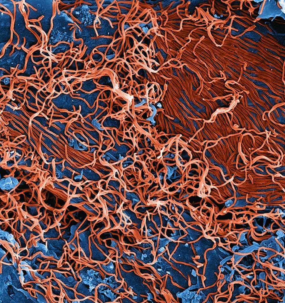 a close up of an orange and blue substance