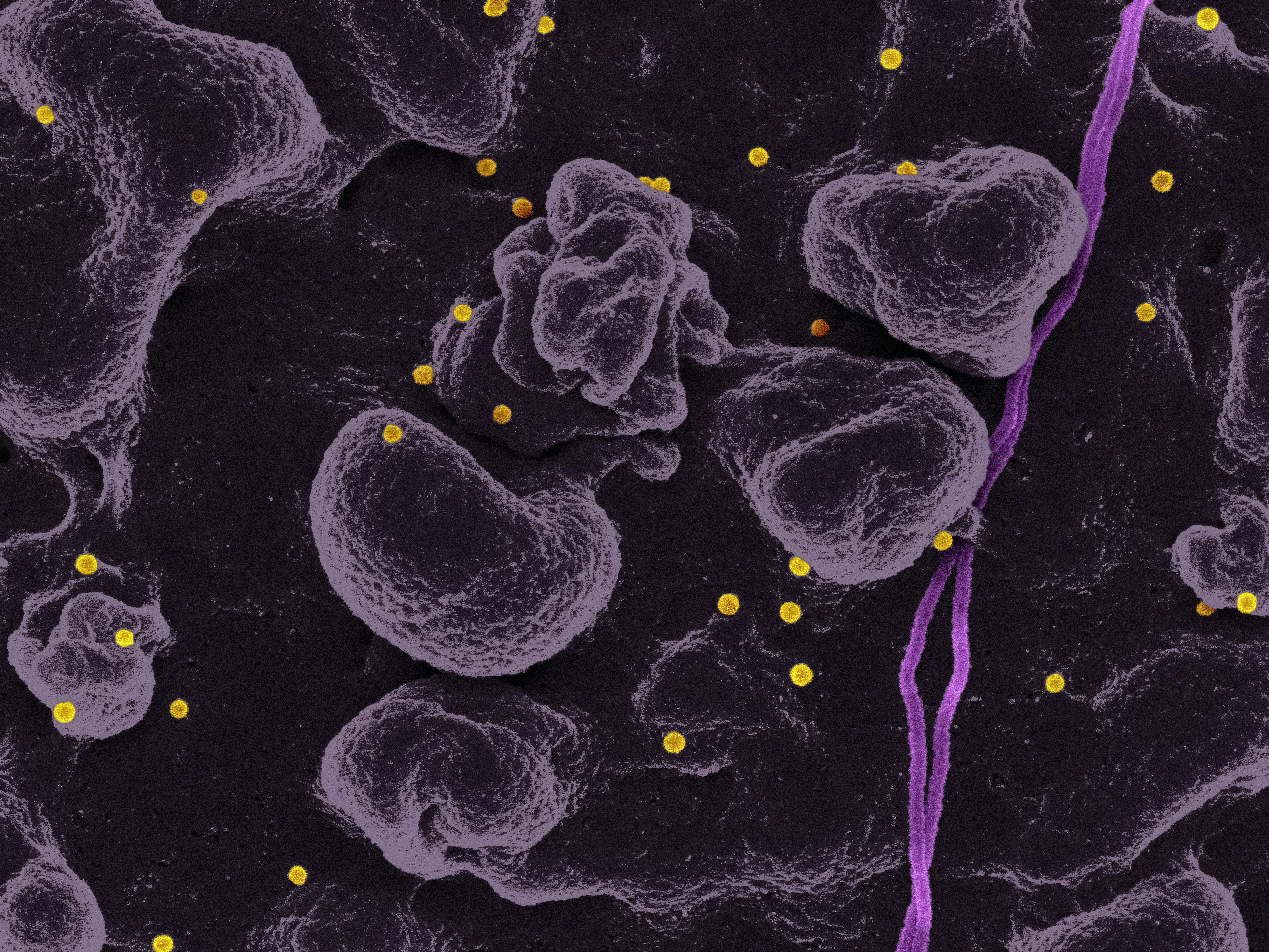 The Overlap Between Mold Illness and Oxalate Sensitivity: The Ultimate Guide