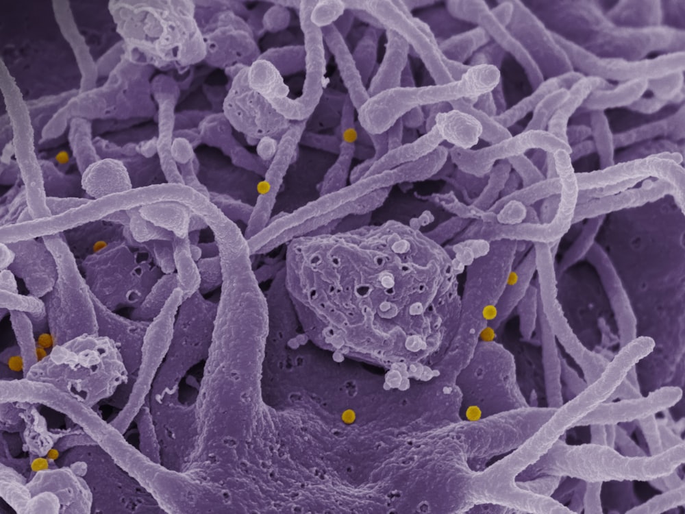 um close up de uma substância roxa com pontos amarelos