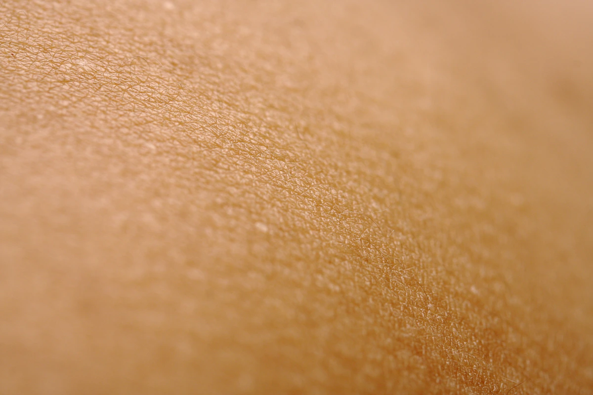 Close-up macro view of skin texture, representing wart assessment