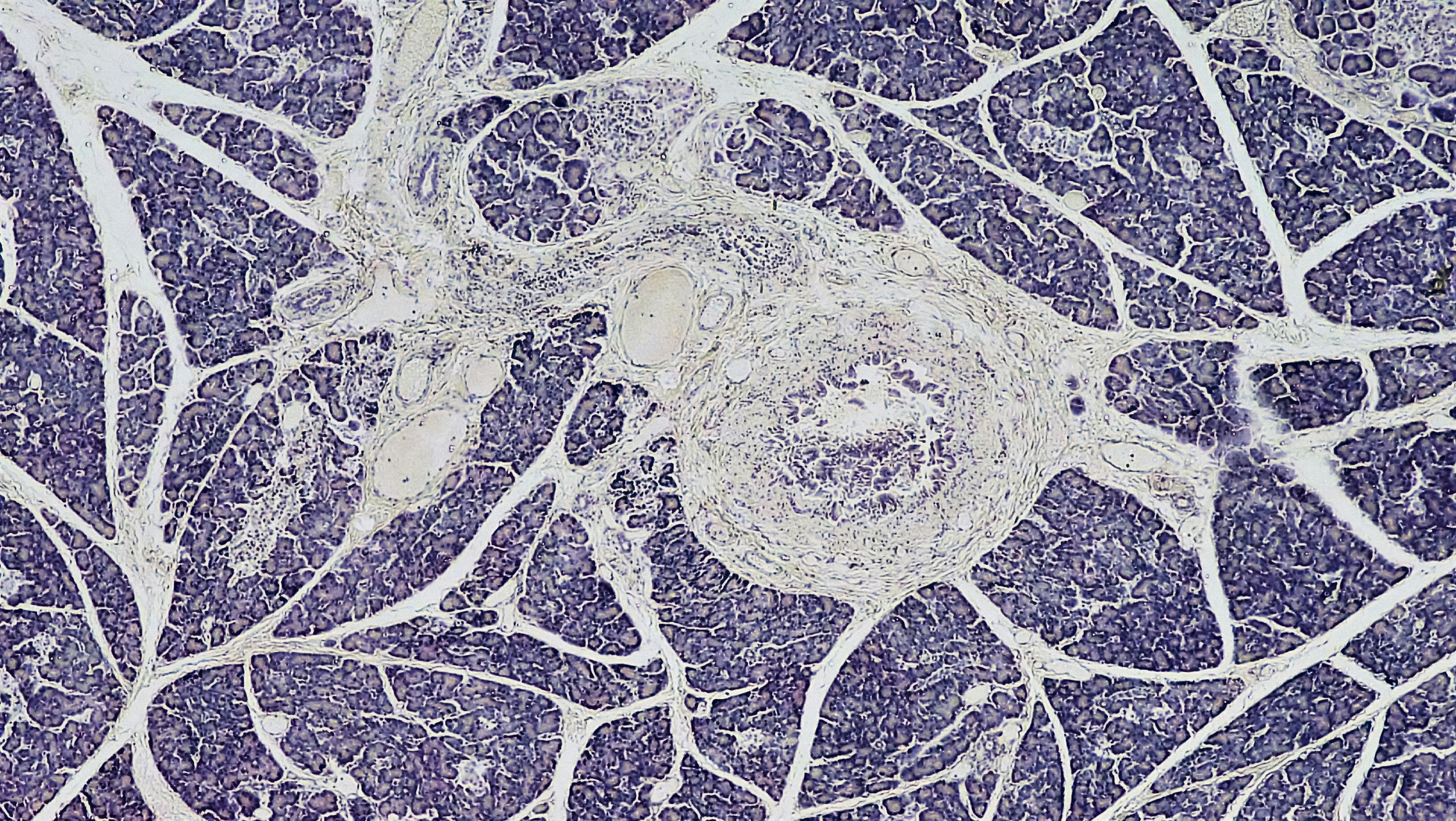 Creating Meaning in a Random Universe