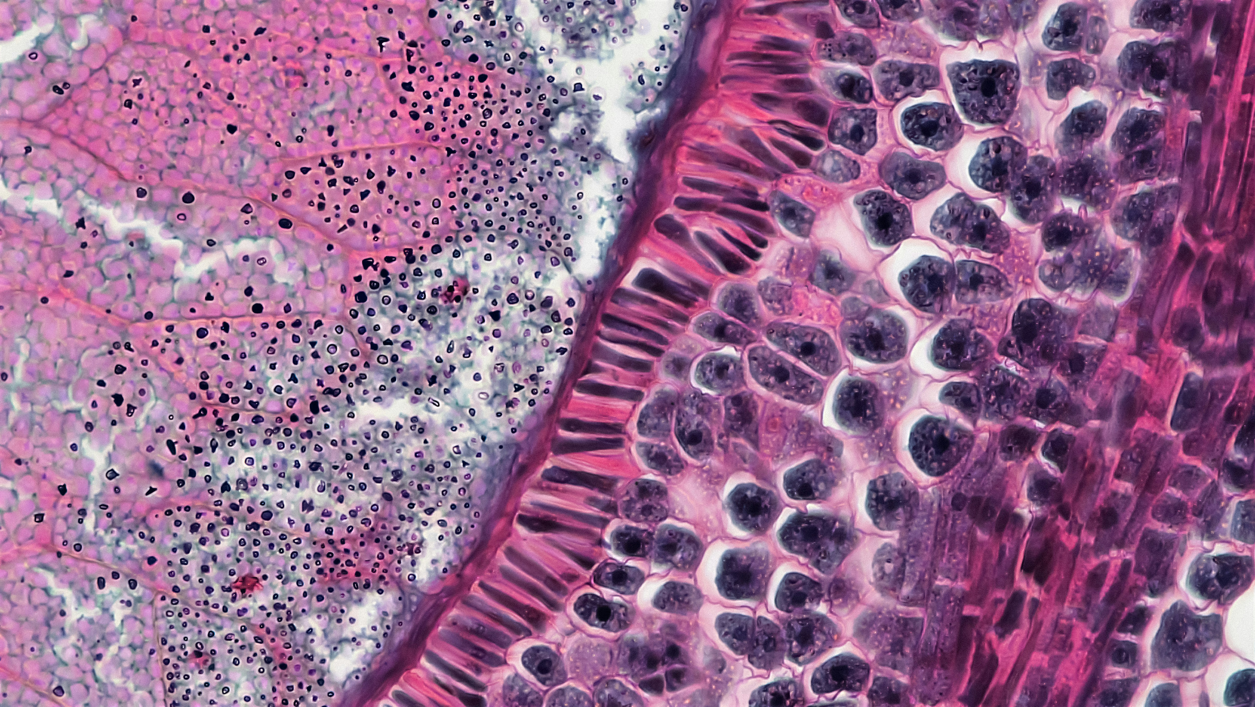 Mucosal Damage and Oxalate-Driven Inflammation: 5 Proven Steps