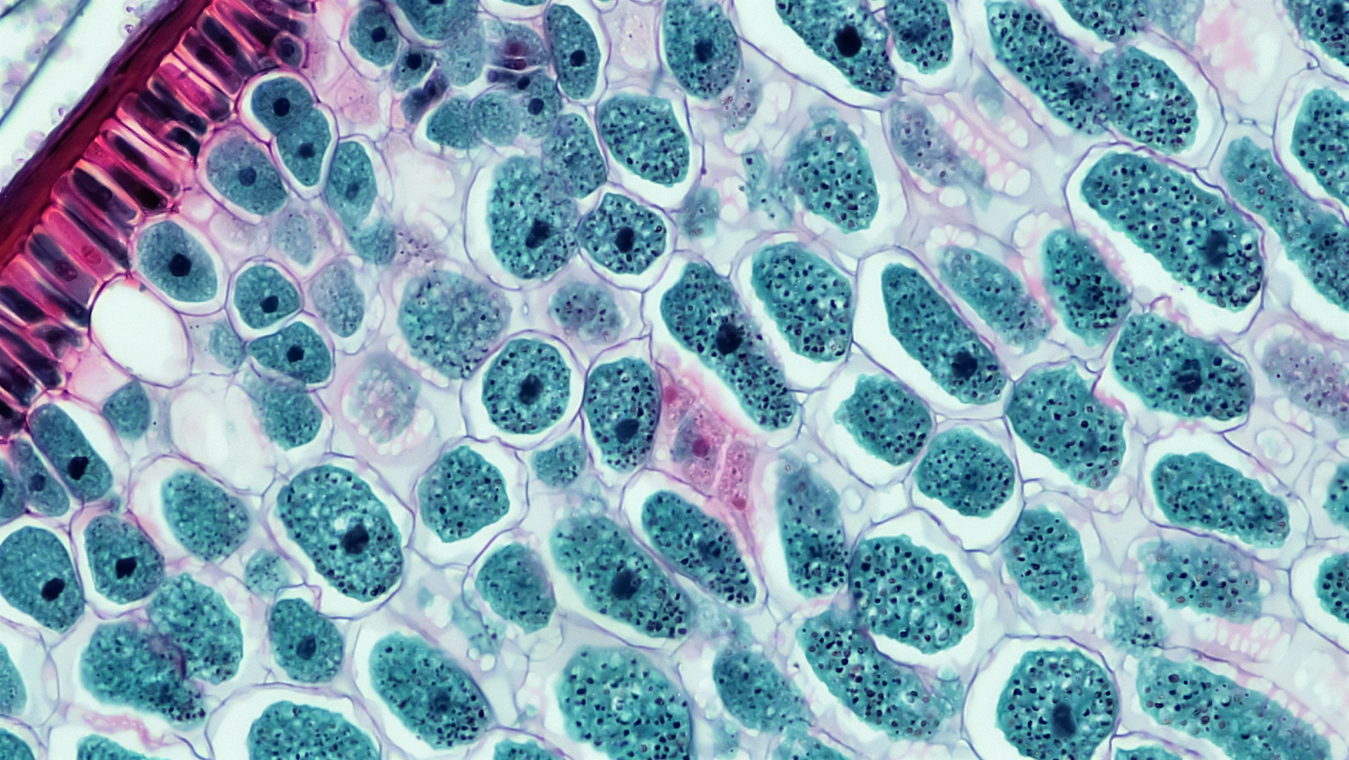 Microscopic view of plant cells with nuclei