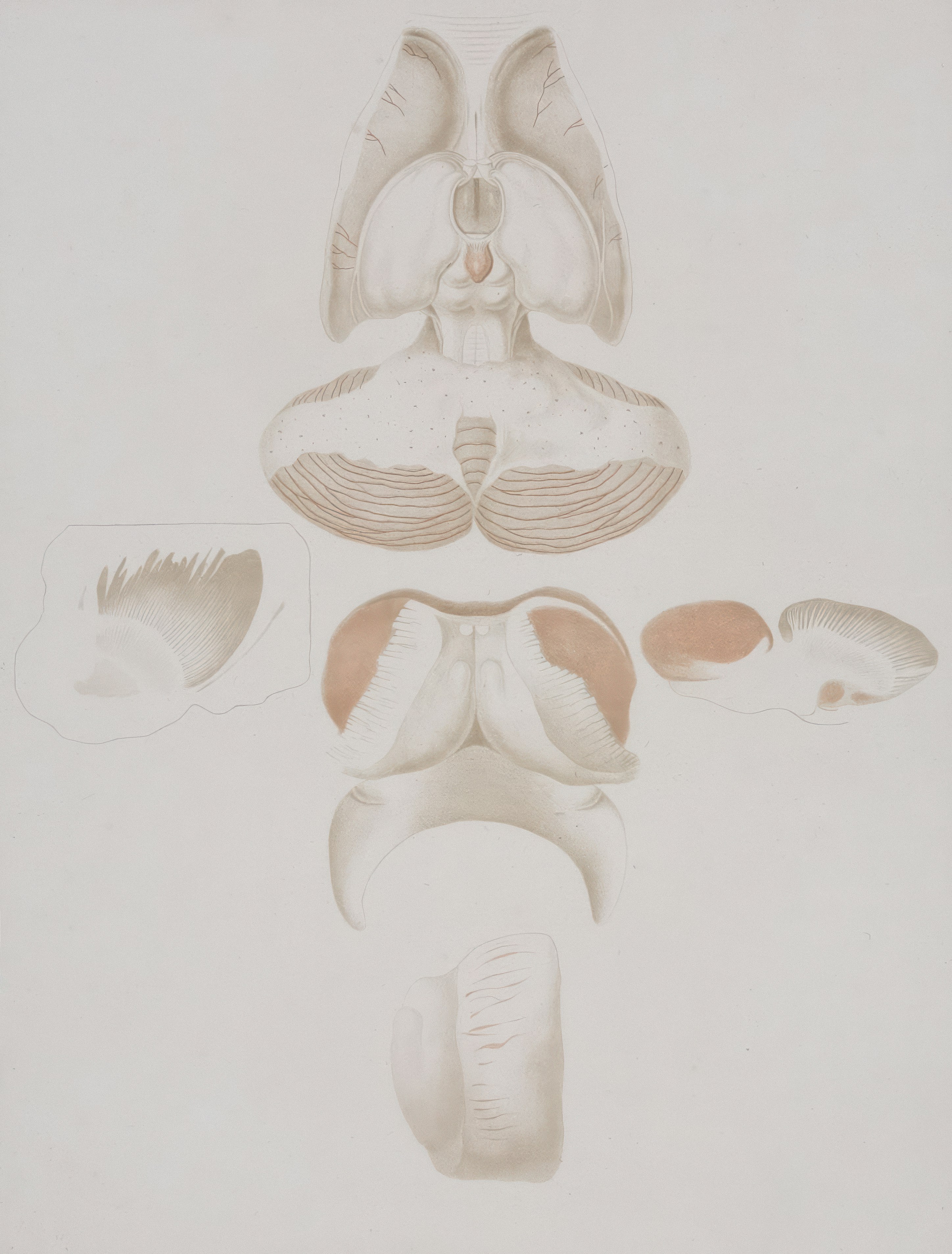 Understanding Brain Changes and Their Impact on MS Risk