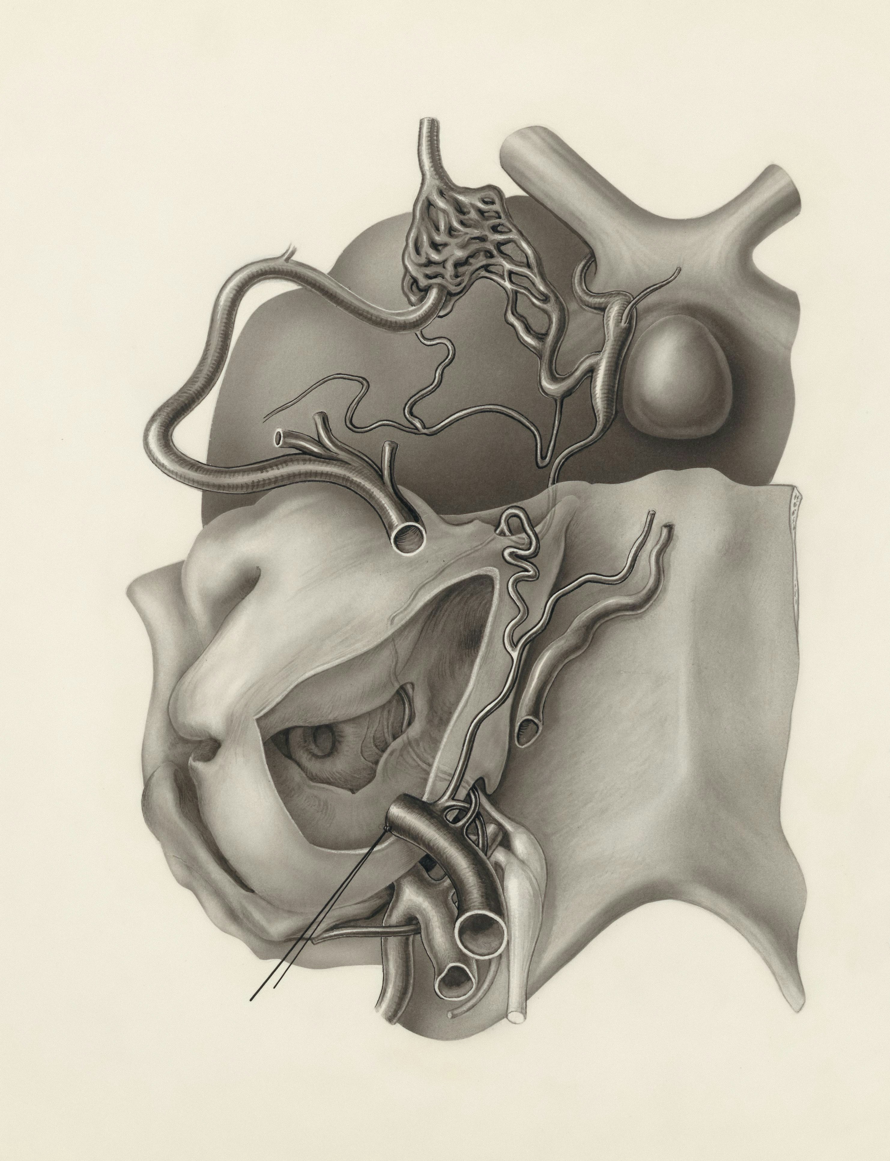 Tratamento inovador para nódulos e tumores de tireoide — Neocure, image size:3000x3913