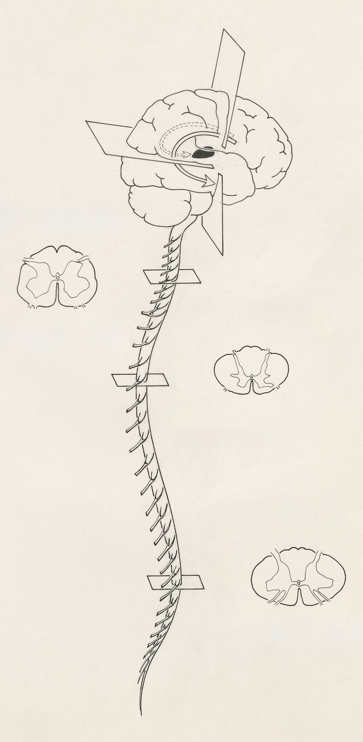 Schleudertrauma Spätfolgen Osteopathie Hamburg: Atlas-Dysfunktion und membranöse Verklebungen langfristig behandeln