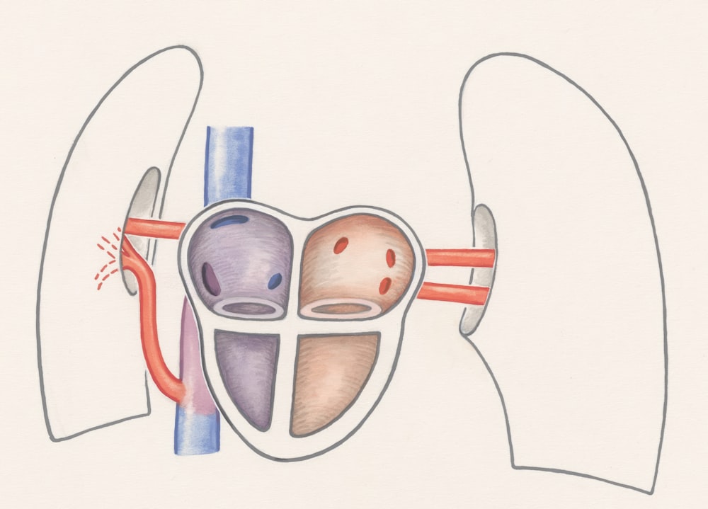 a drawing of a diagram of the kidney