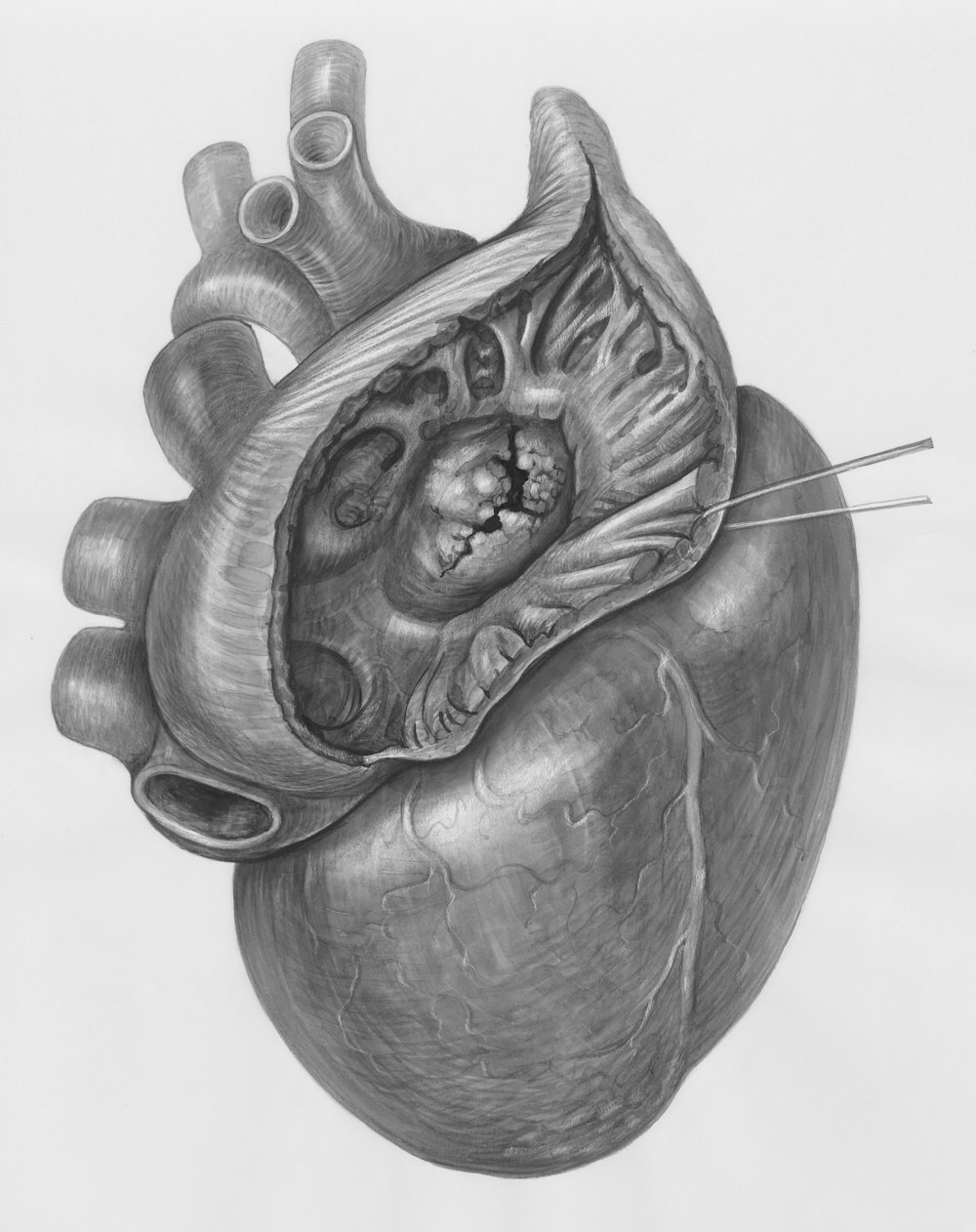 a drawing of a heart with a needle in it