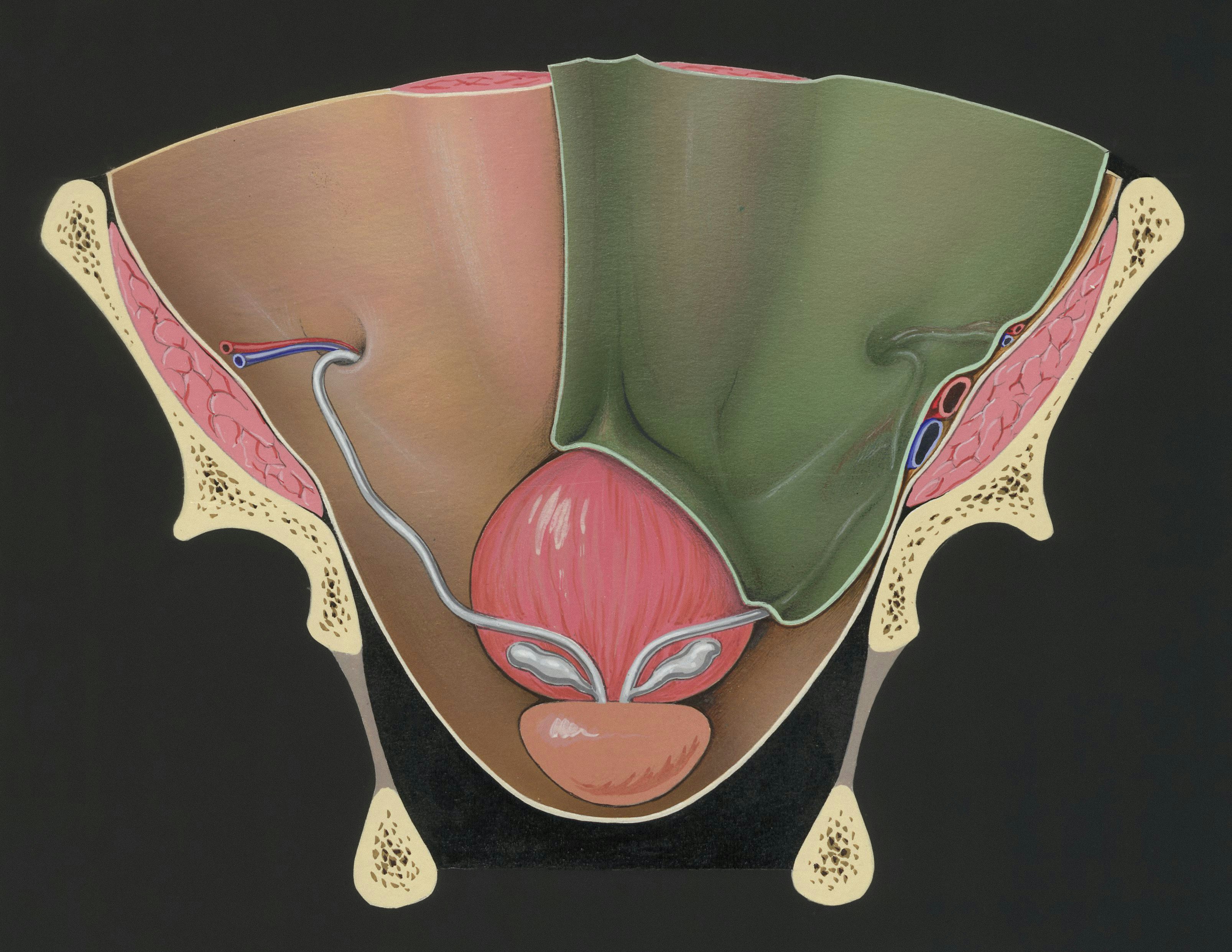 Title: Prostate and adjacent tissue Creator: Tinkelenberg, J Date: 1970-04-02 Providing institution: Universitaire Bibliotheken Leiden Aggregator: Dutch Collections for Europe Providing Country: Netherlands Public Domain Prostate and adjacent tissue by Tinkelenberg, J - Leiden University Libraries, Netherlands - Public Domain. https://www.europeana.eu/item/744/item_3462041