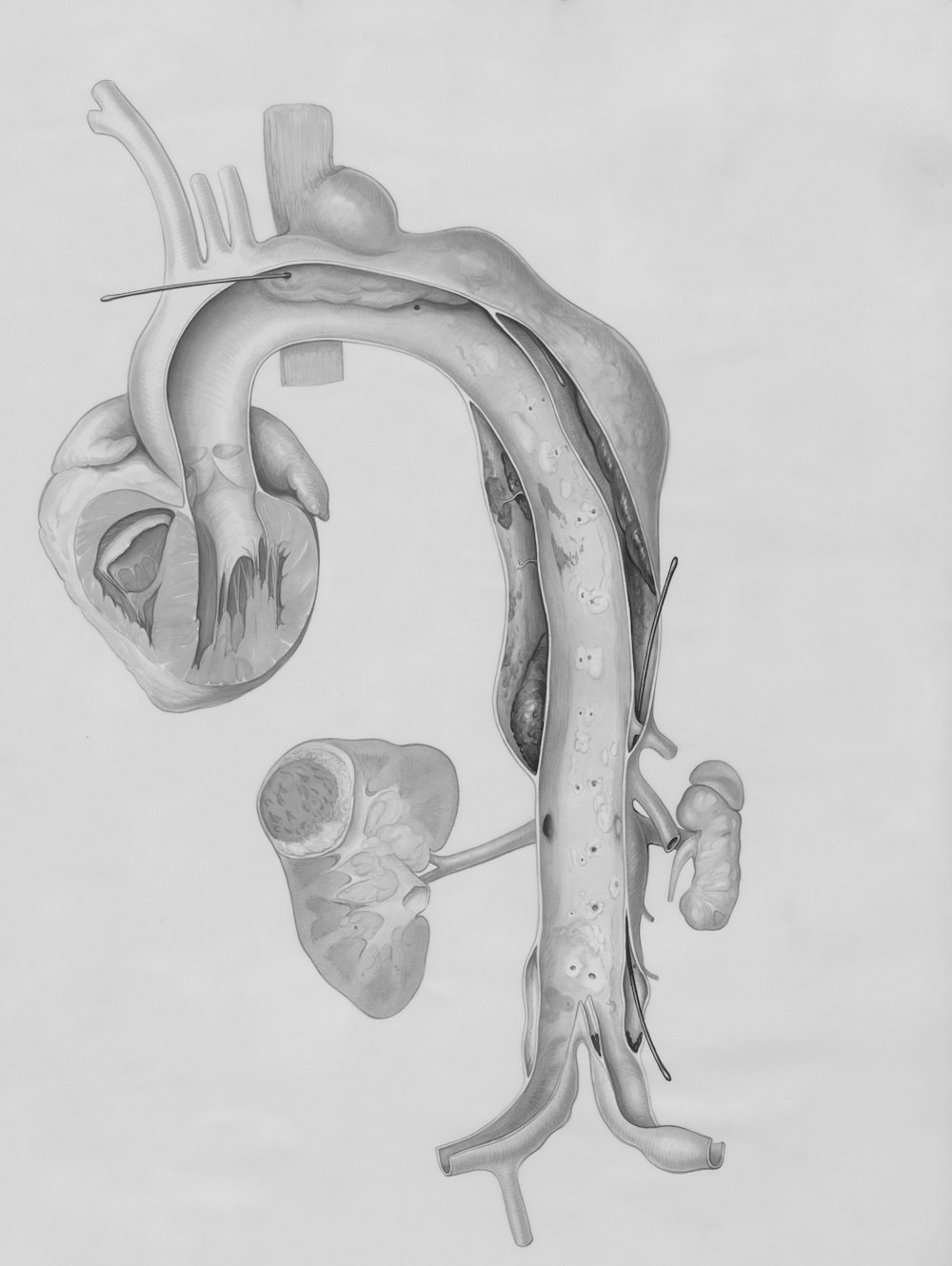 Un dibujo en blanco y negro de un corazón humano