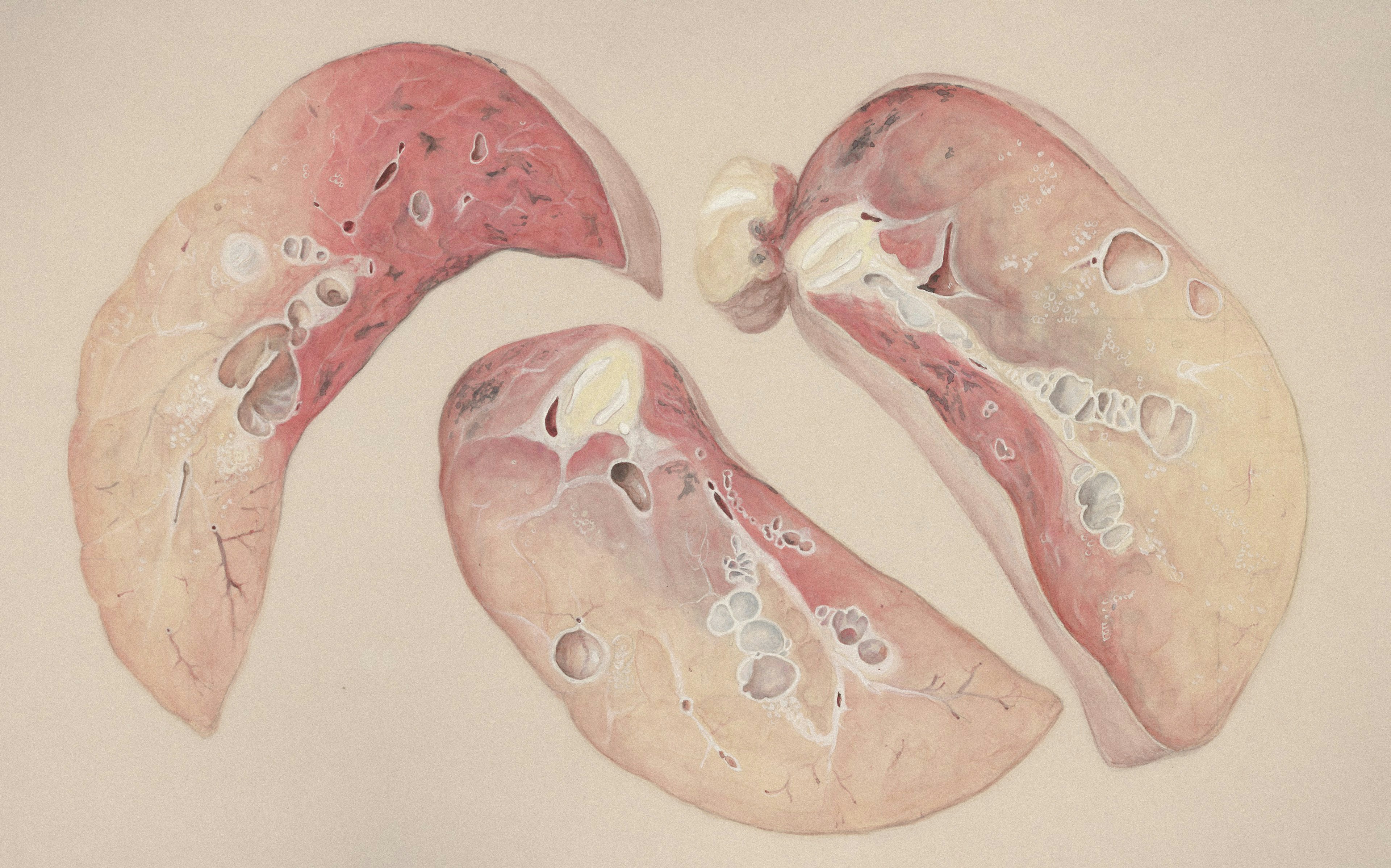 Title: Lung tissue Creator: Wetselaar-Whittaker, J Date: 1950/1990 Providing institution: Universitaire Bibliotheken Leiden Aggregator: Dutch Collections for Europe Providing Country: Netherlands Public Domain Lung tissue by Wetselaar-Whittaker, J - Leiden University Libraries, Netherlands - Public Domain. https://www.europeana.eu/item/744/item_3462383
