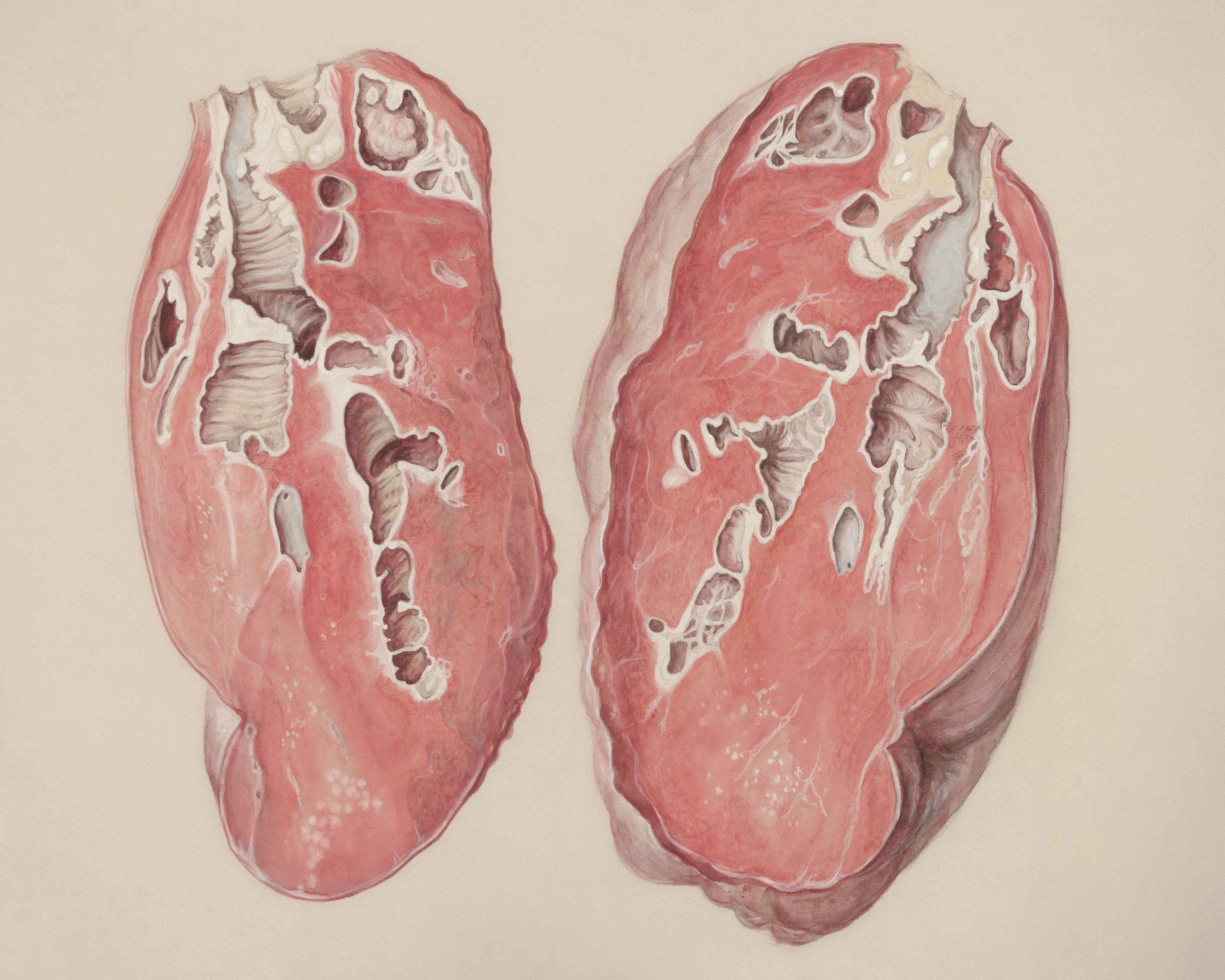 Title: Lung tissue Creator: Wetselaar-Whittaker, J Date: 1950/1990 Providing institution: Universitaire Bibliotheken Leiden Aggregator: Dutch Collections for Europe Providing Country: Netherlands Public Domain Lung tissue by Wetselaar-Whittaker, J - Leiden University Libraries, Netherlands - Public Domain. https://www.europeana.eu/item/744/item_3462372