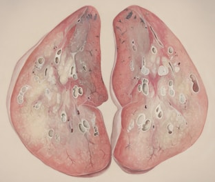 a medical illustration of the lungs