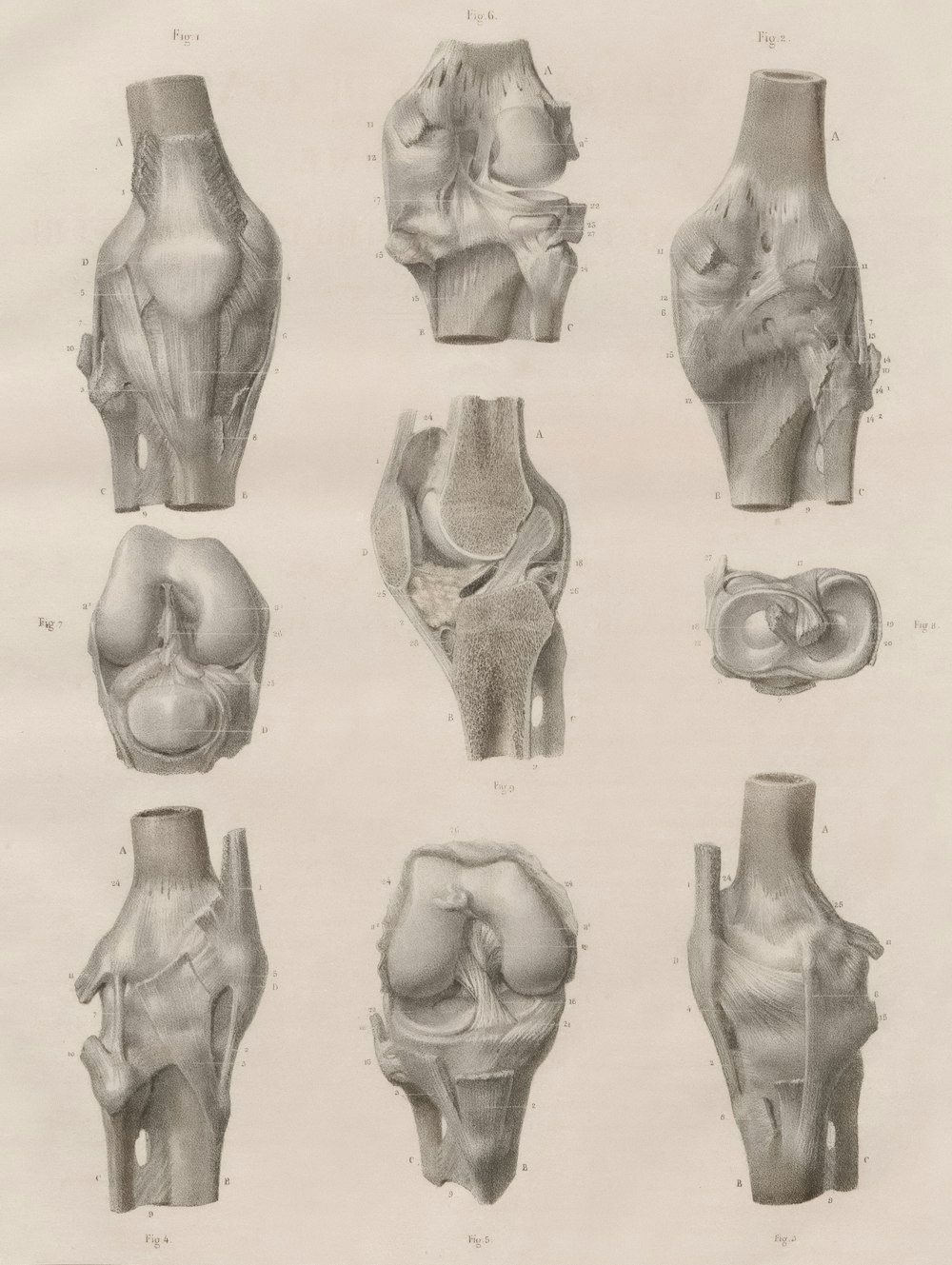a drawing of different types of bones