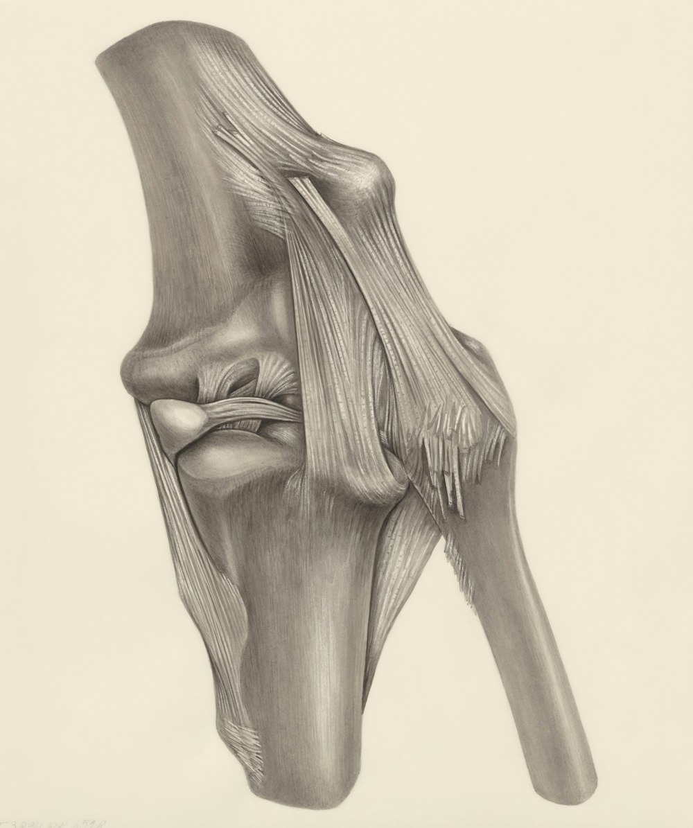 a drawing of the knee showing the knee joint